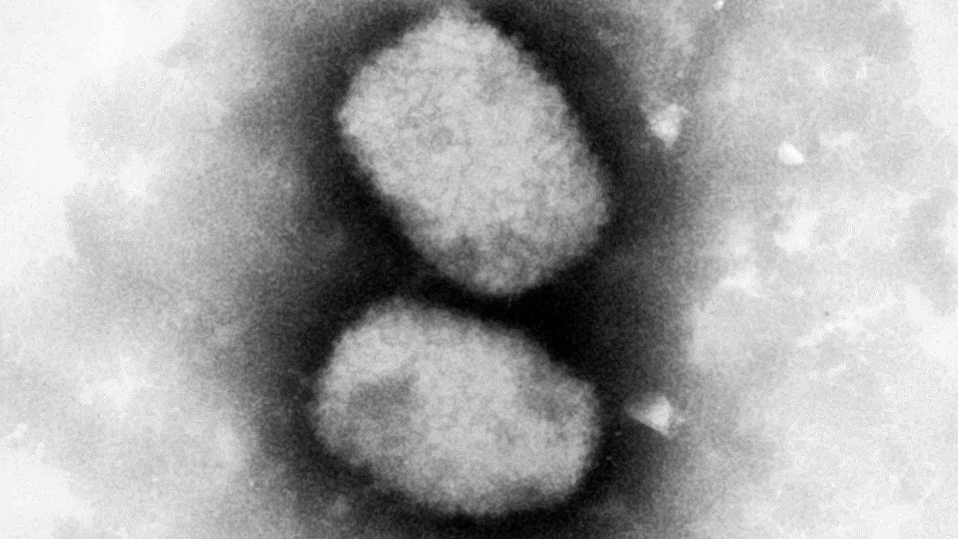 Eine vom Robert Koch-Institut (RKI) zur Verfügung gestellte elektronenmikroskopische Aufnahme des Affenpockenvirus