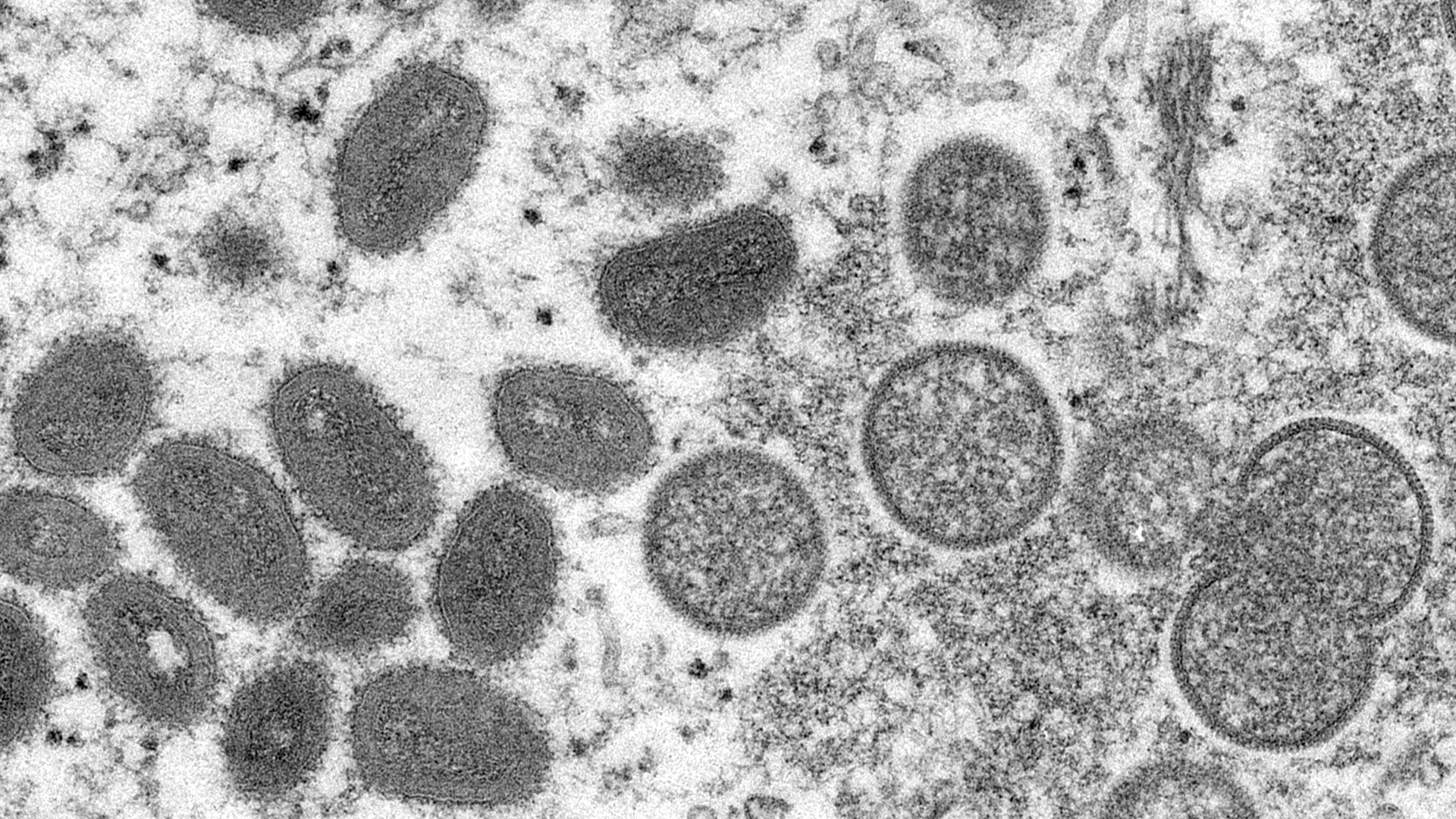 Die elektronenmikroskopische Aufnahme aus dem Jahr 2003, die von den Centers for Disease Control and Prevention zur Verfügung gestellt wurde, zeigt reife, ovale Affenpockenviren (l) und kugelförmige unreife Virionen (r)
