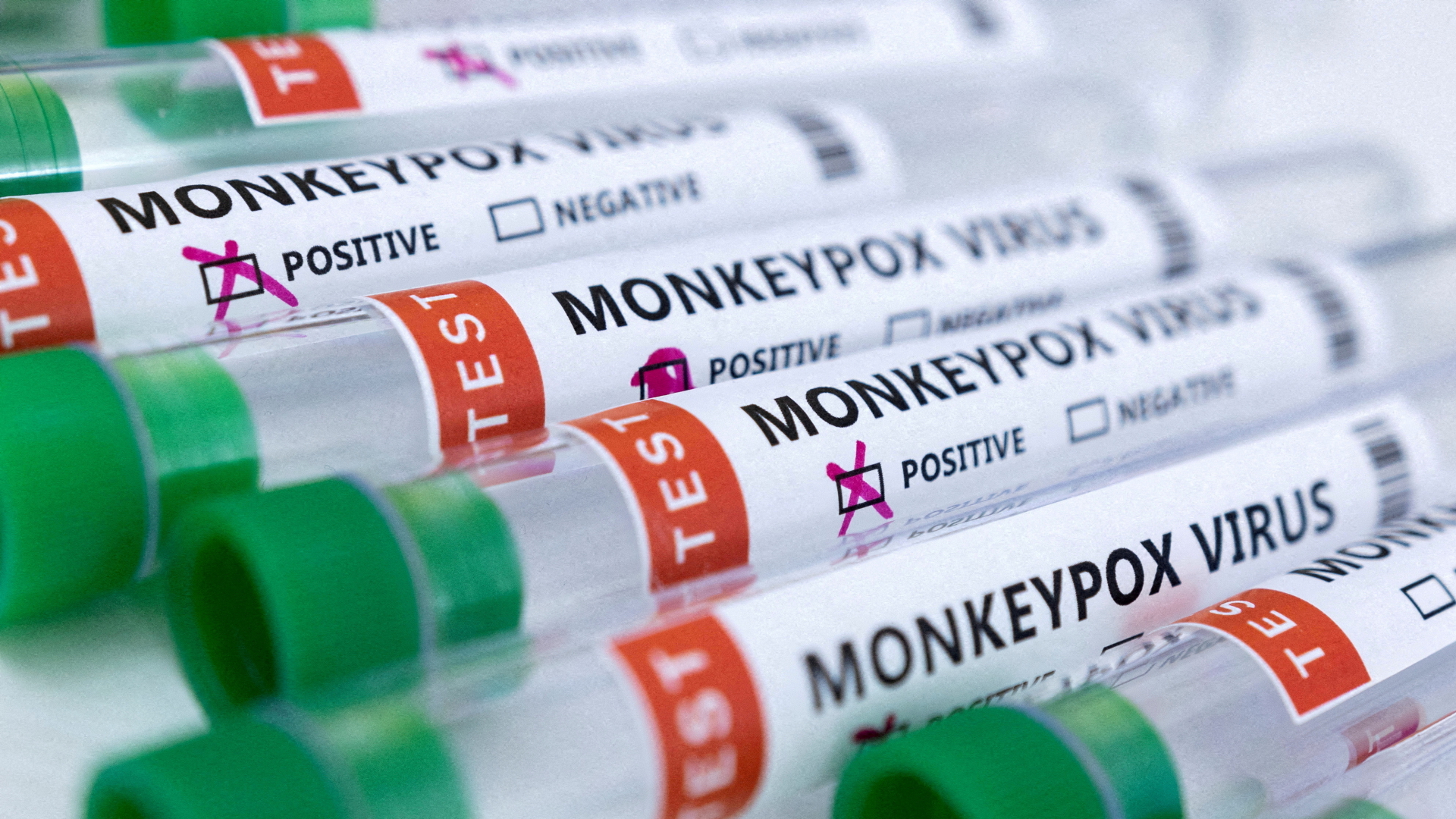 Reagenzgläser mit der Aufschrift "Affenpockenvirus positiv und negativ". | REUTERS