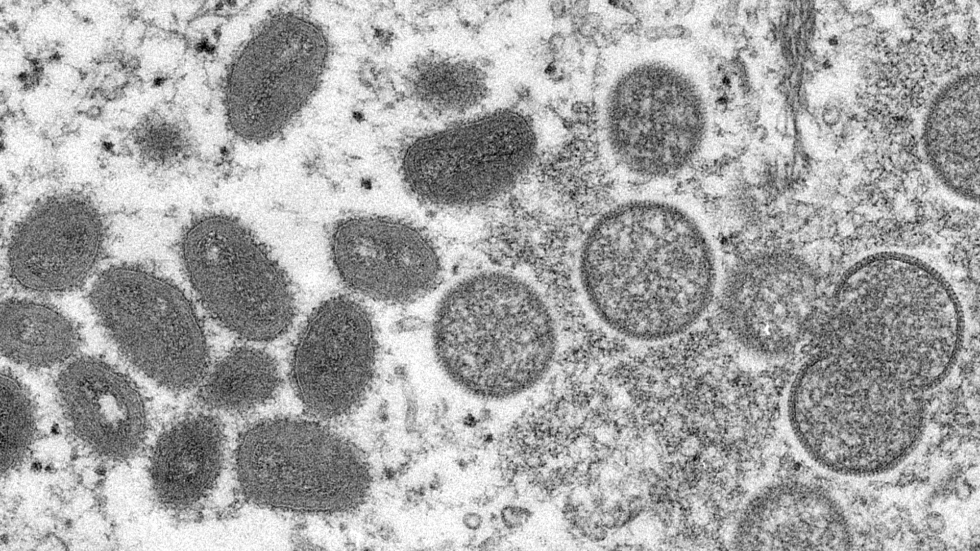 Diese elektronenmikroskopische Aufnahme aus dem Jahr 2003, die von den Centers for Disease Control and Prevention zur Verfügung gestellt wurde, zeigt reife, ovale Affenpockenviren (l) und kugelförmige unreife Virionen (r), die aus einer menschlichen Hautprobe im Zusammenhang mit dem Präriehundeausbruch von 2003 stammt (Archivbild). | dpa