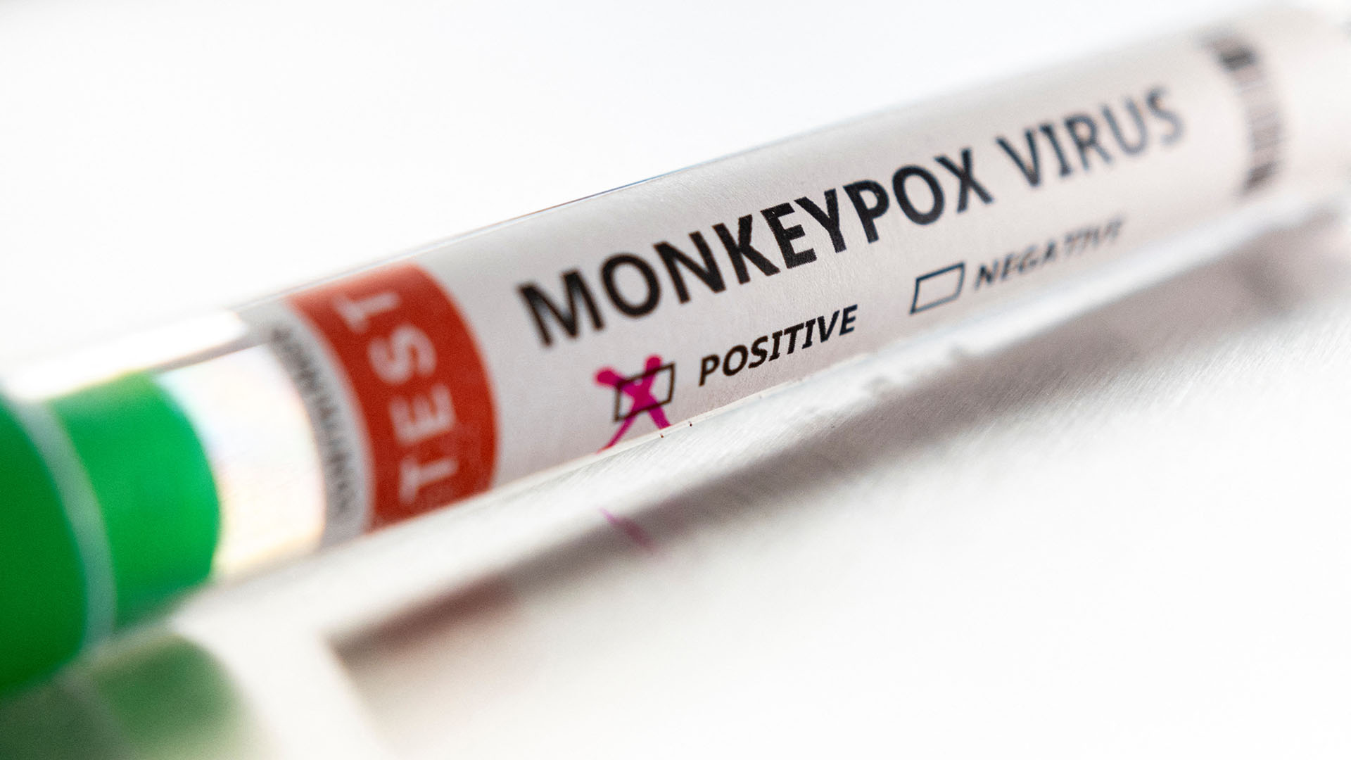 Ein Röhrchen mit dem Label "Monkeypox Virus positive" (Illustration) | REUTERS