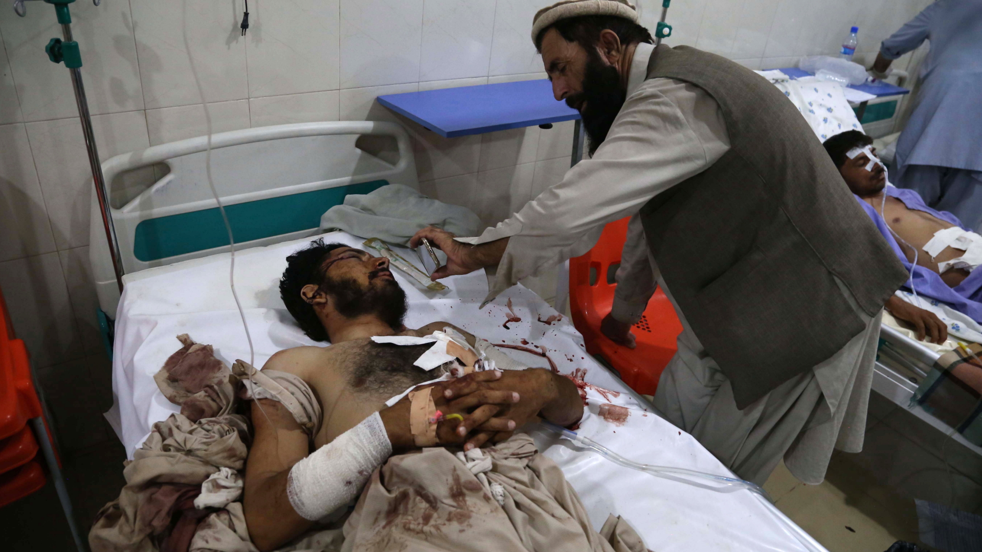 Verletzter in einem Krankenhaus in Dschalalabad in Afghanistan | Bildquelle: GHULAMULLAH HABIBI/EPA-EFE/REX/S