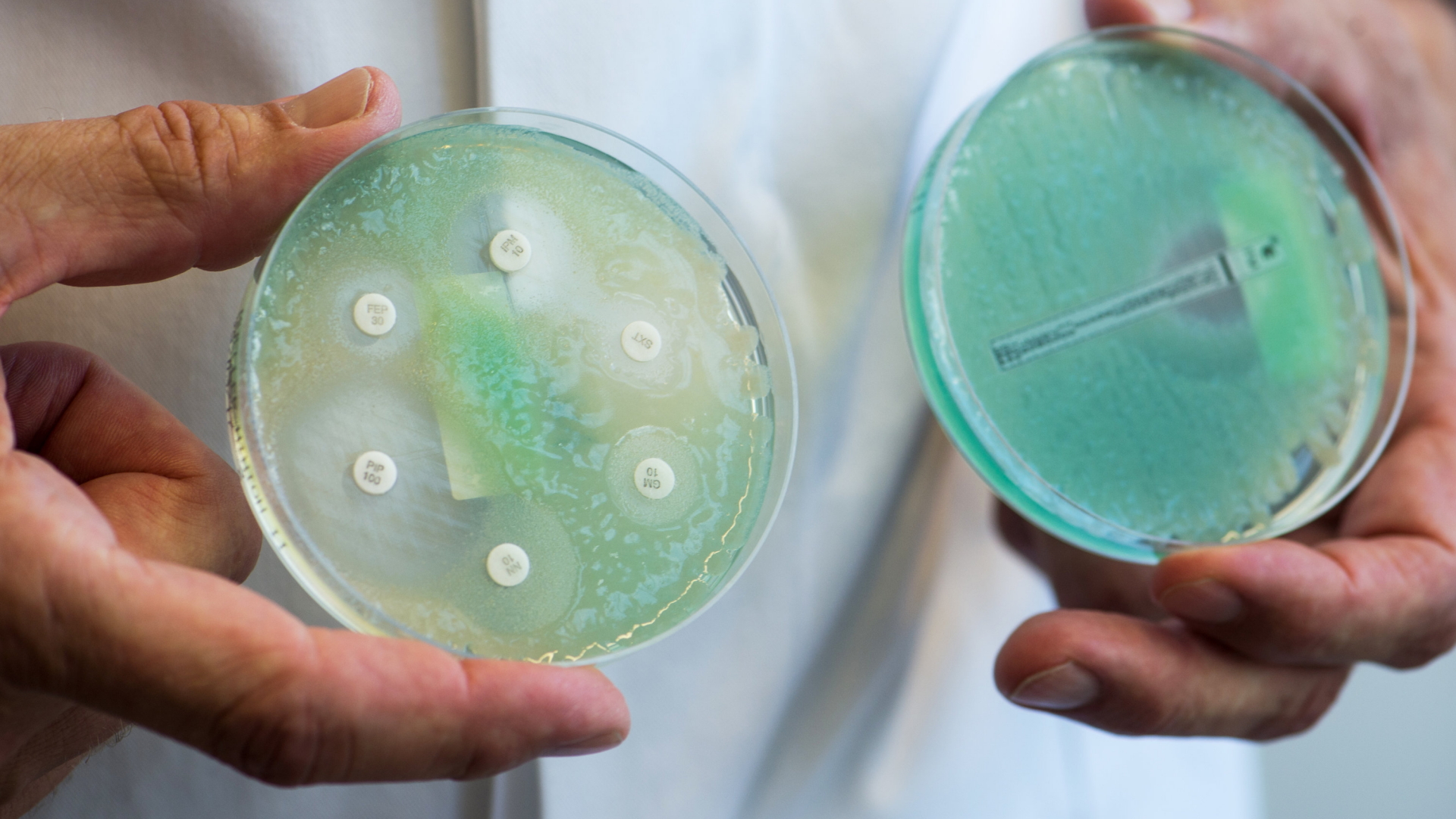 Petrischalen mit sogenannten Krankenhauskeimen, die Mehrfachresistenzen gegenüber Antibiotika aufweisen.  | dpa