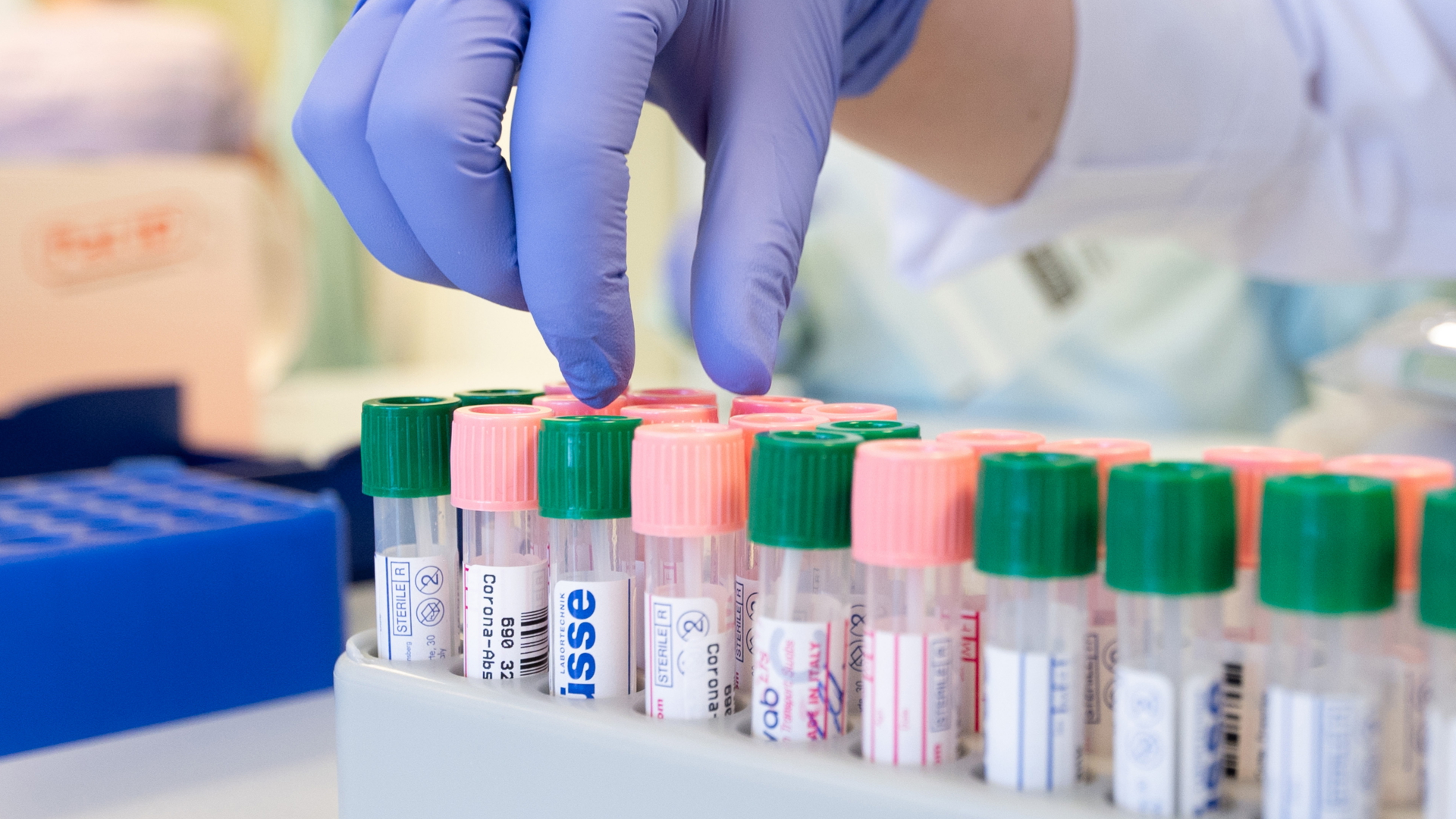 Labormitarbeiterinnen etikettieren in einem medizinischen Labor in Dresden eine Kassette mit Corona-Abstrichen zum Virusnachweis unter Verwendung der PCR-Methode.  | dpa