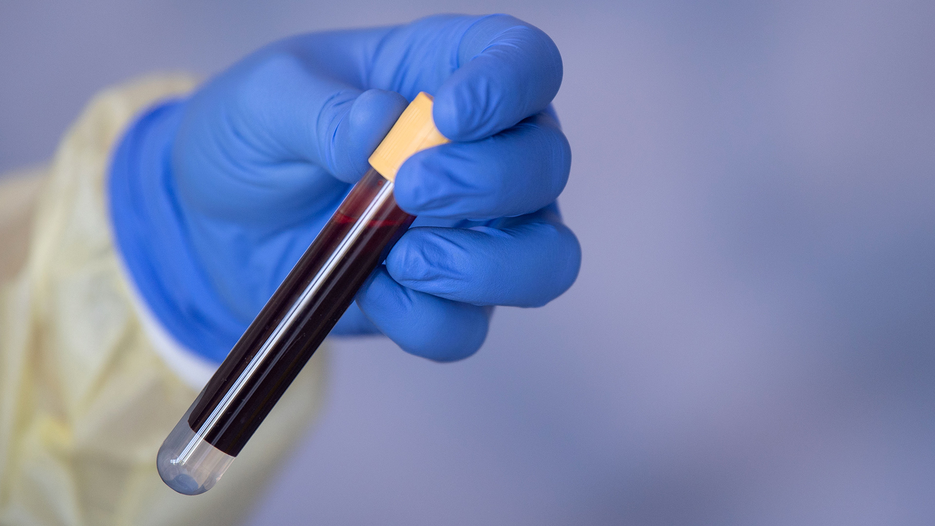 Eine Blutprobe für einen Antikörpertest | dpa