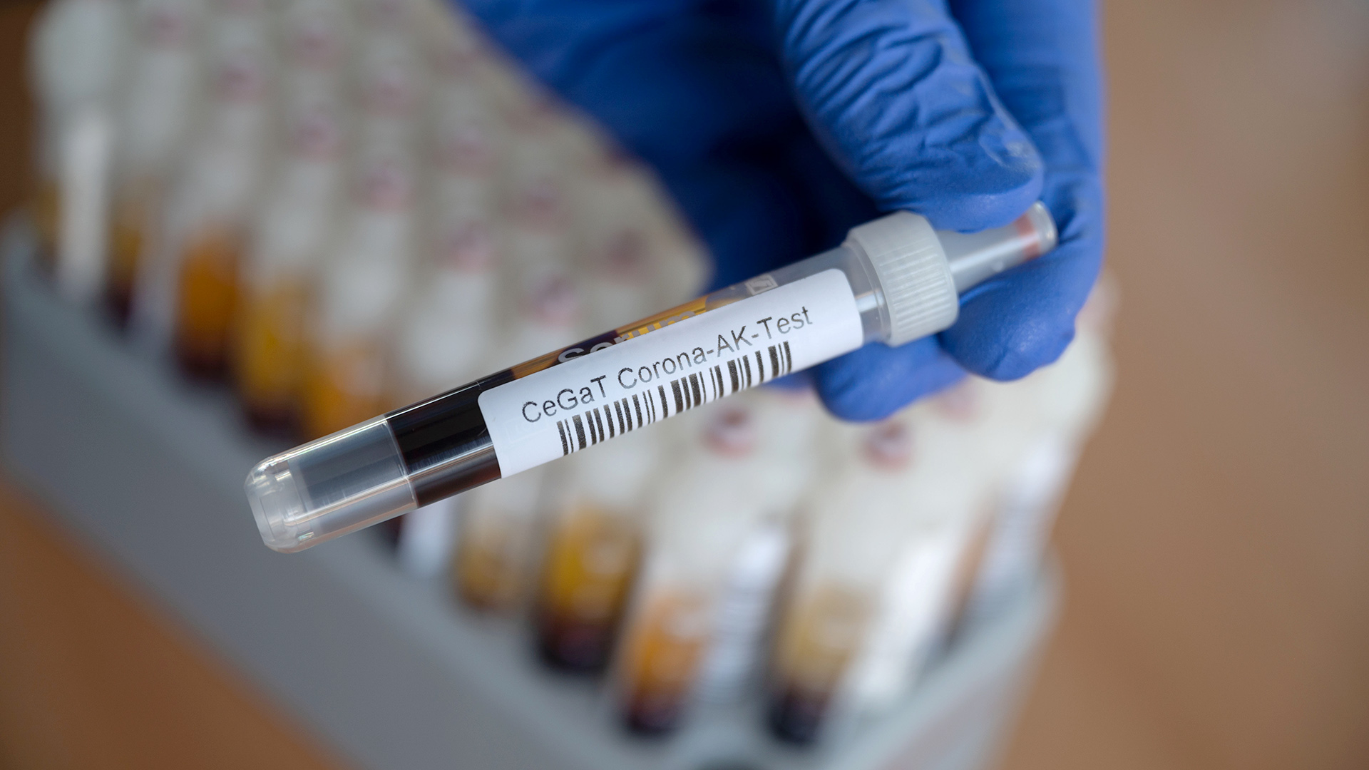 Eine Mitarbeiterin des Tübinger Humangenetik-Labors CeGaT hat ein Blutentnahmeröhrchen mit einer Blutprobe für einen Corona-Antikörper-Test in der Hand
