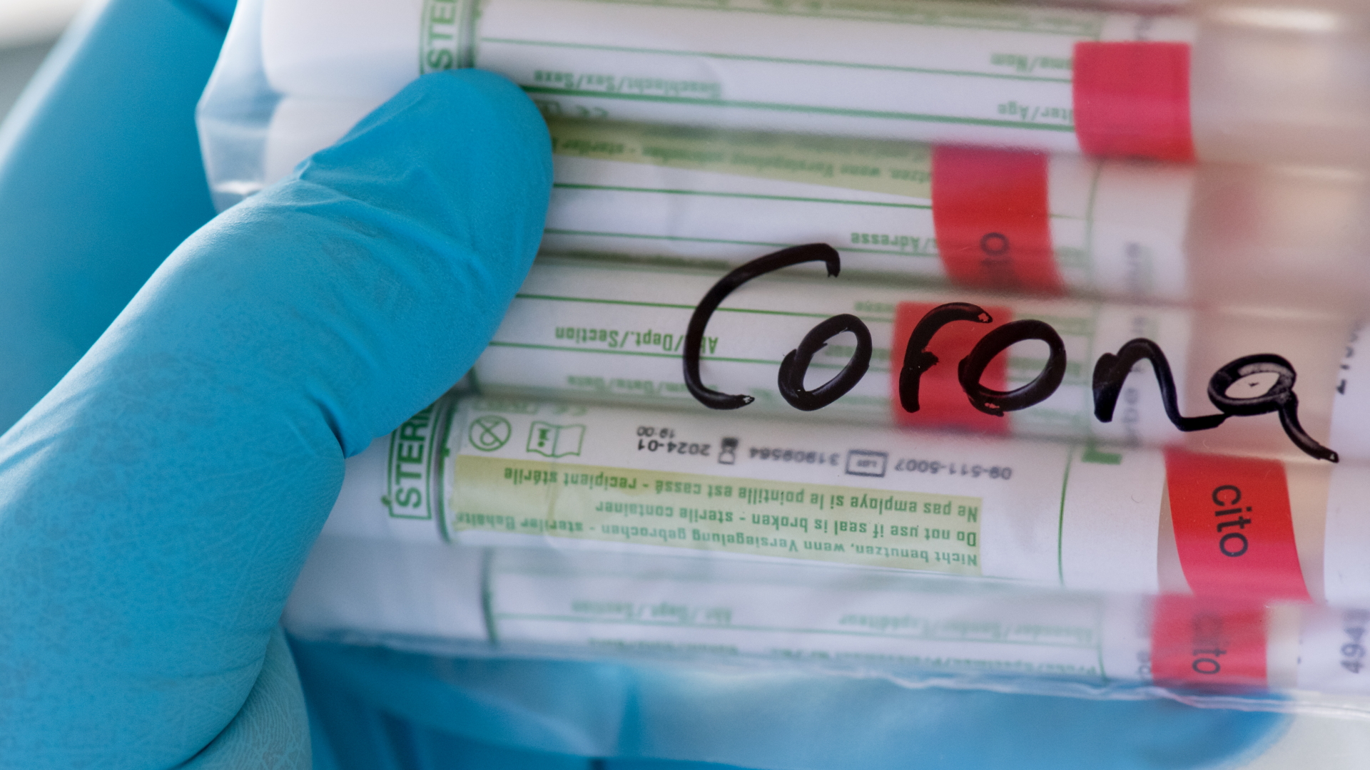 Proben für Corona-Tests werden im Diagnosticum-Labor in Plauen für die weitere Untersuchung vorbereitet. | dpa