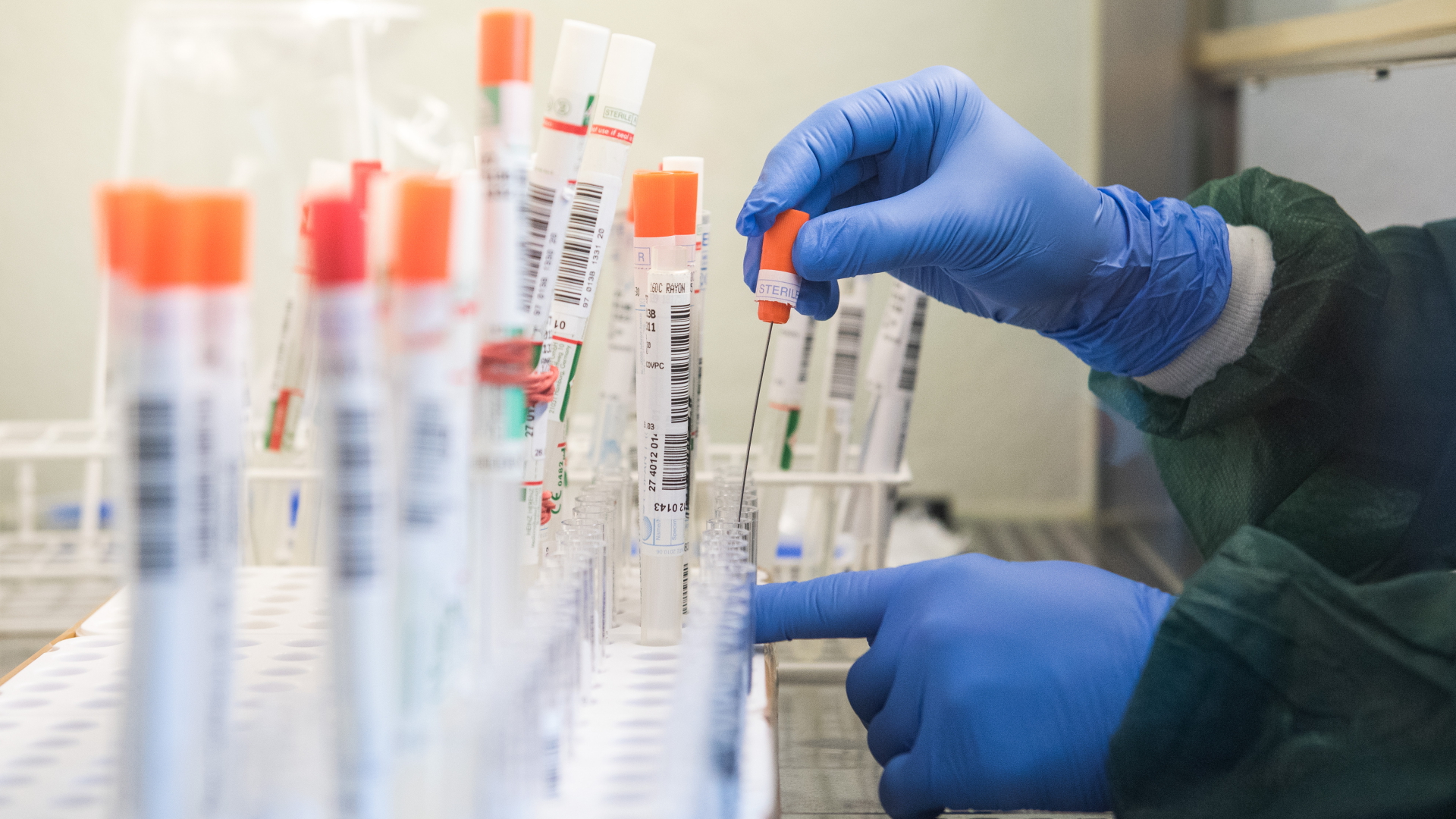 Eine Mitarbeiterin eines Labors überführt einen trockenen Abstrich eines molekularbiologischen Tests auf das SARS-CoV-2-Virus in eine Flüssigkeit. | dpa