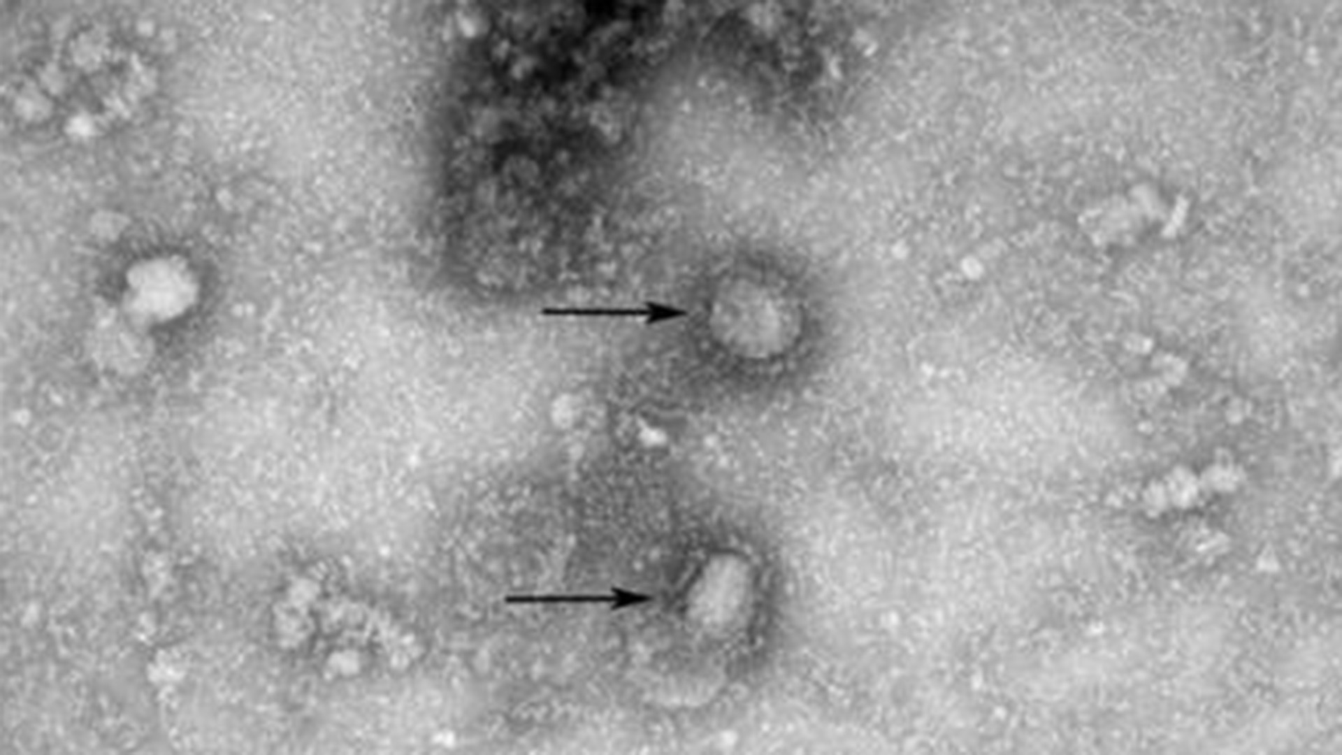 Neuer Stamm des Coronavirus |  IVDC/China CDC via GISAID/dpa