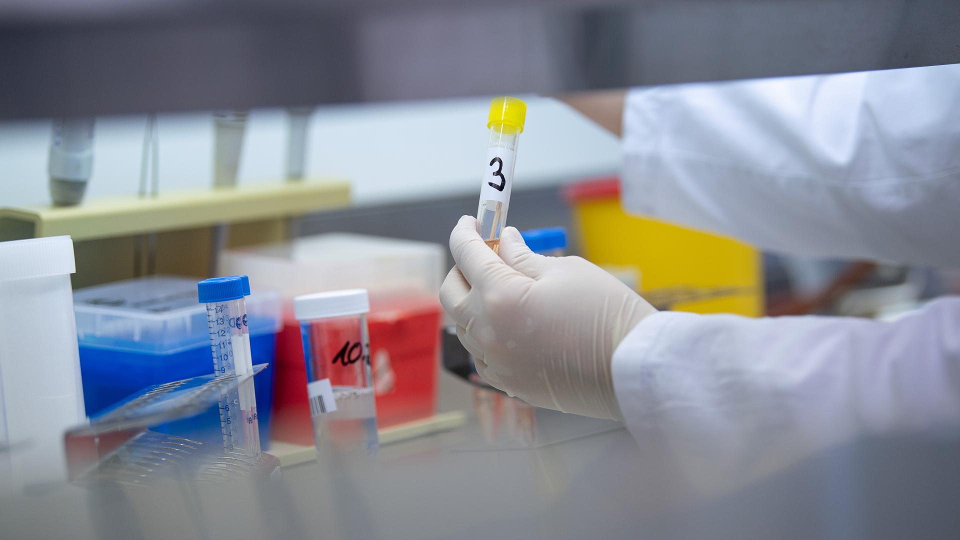 Eine Frau zeigt während eines Presserundgangs in einem Labor des Landesgesundheitsamtes einen Test für das neue Virus 2019-nCov. (Archivbild)