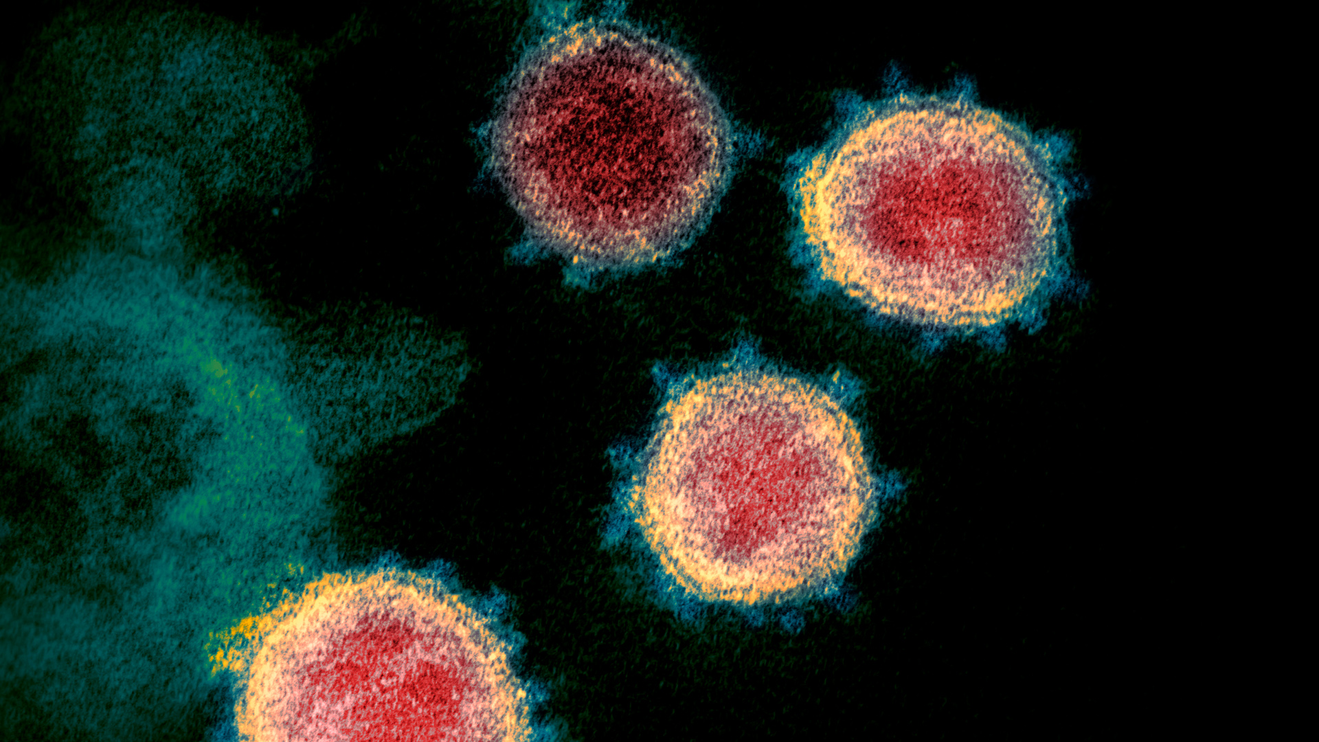 Neue Coronavirus Varianten Wie gefährlich sind die Mutationen ...