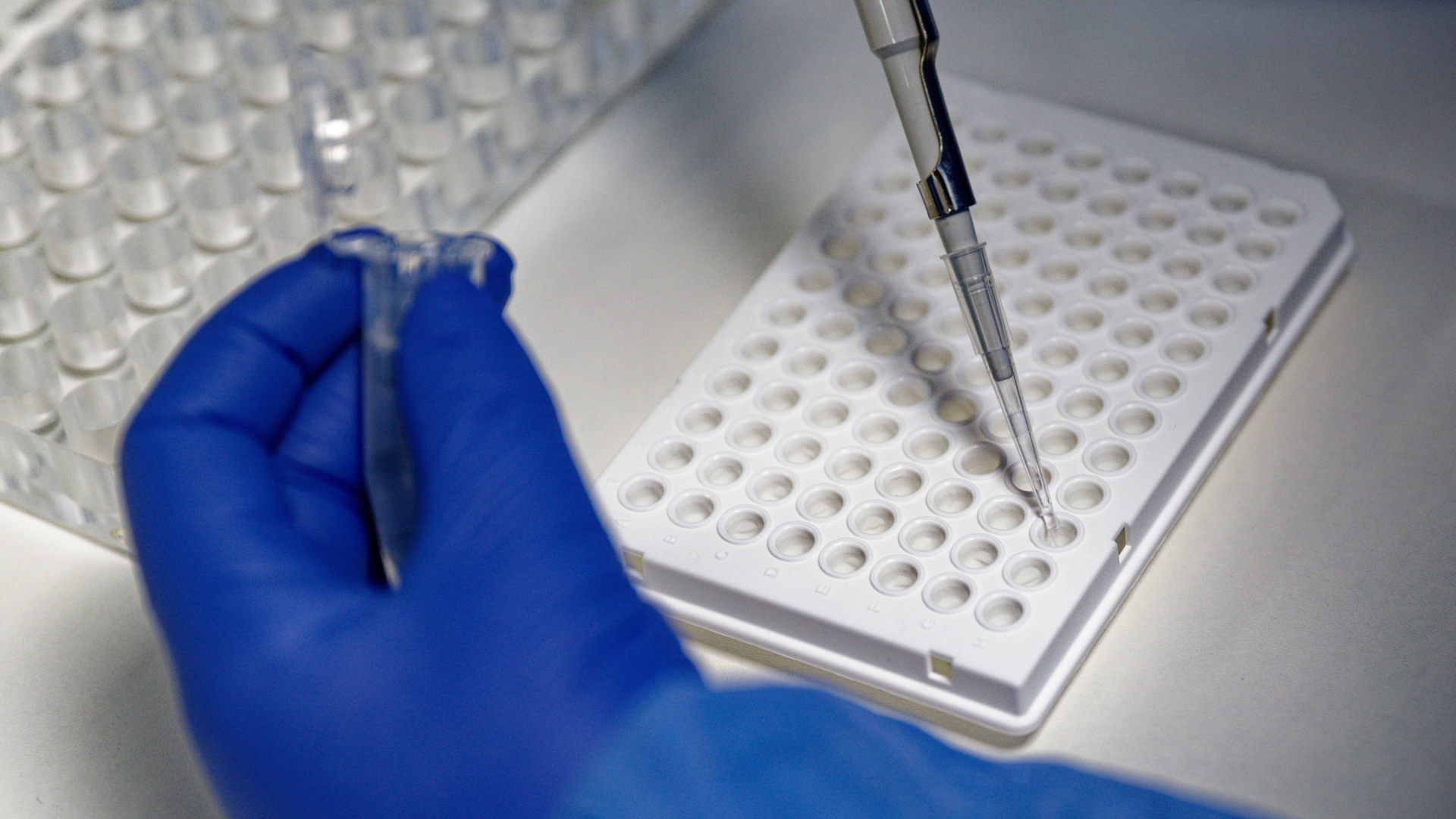 Eine Mitarbeiterin des Labors CBT füllt mit einer Pipette zur Vorbereitung von Corona PCR Tests eine Testflüssigkeit in einer Trägerplatte. 