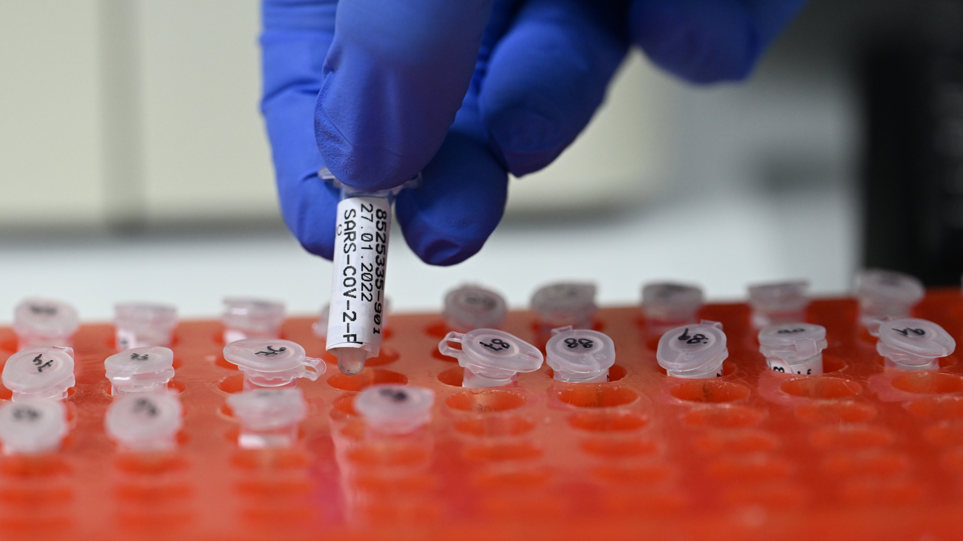 Eine Mitarbeiterin des PCR Testlabors des Stuttgarter Robert Bosch Krankenhauses bereitet PCR Tests vor. | dpa