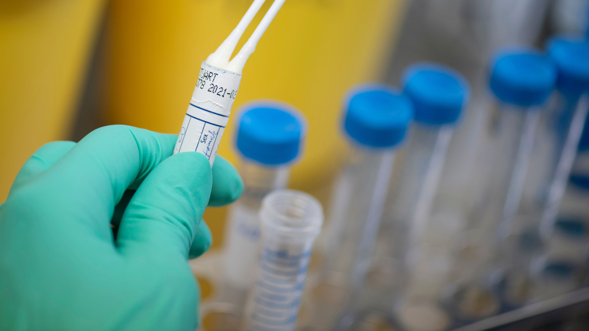 In einem Labor in Stuttgart wird der Test auf das neuartige Coronavirus demonstriert. | Bildquelle: AFP