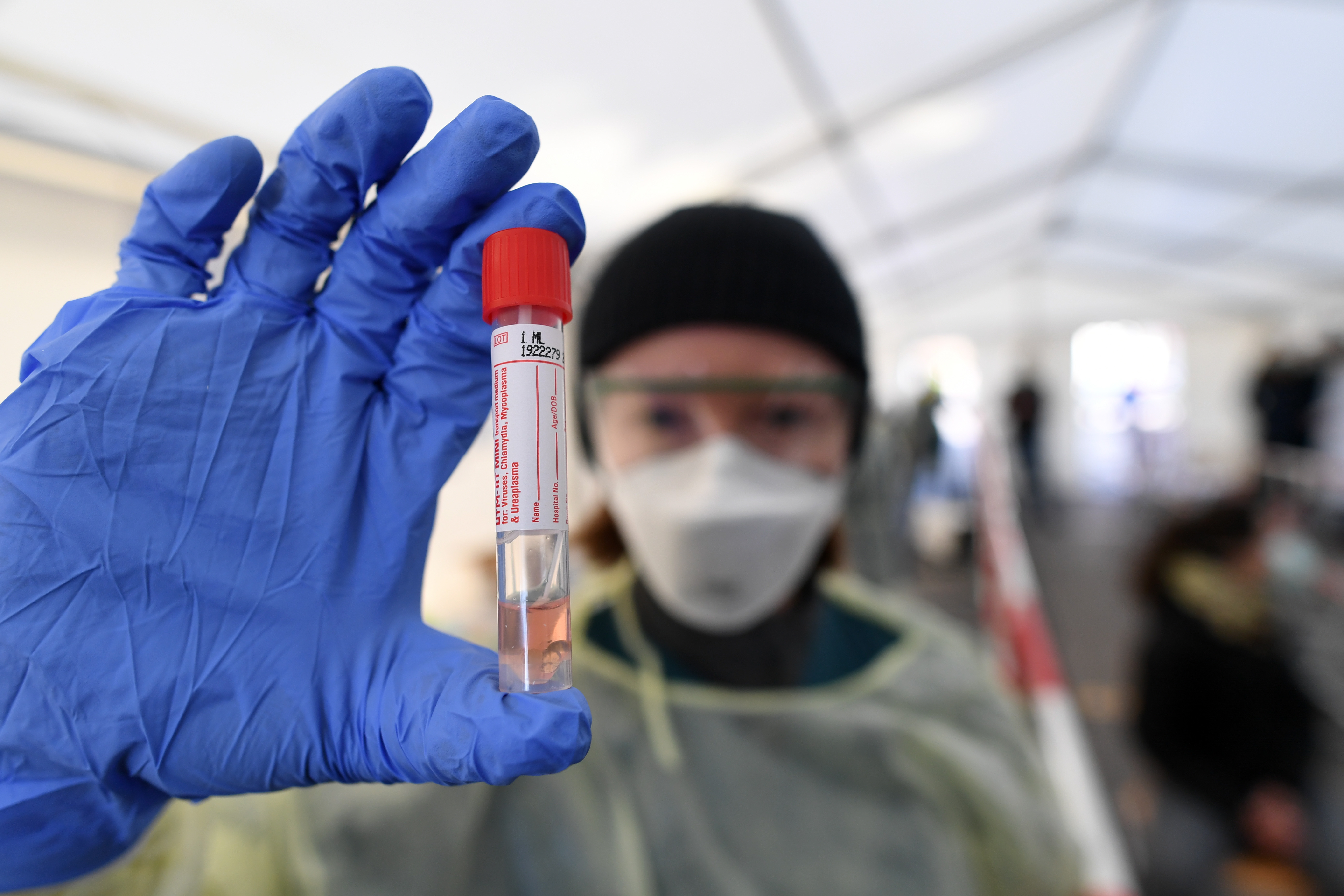 Photo of Koronapandemie: 11.409 Neuinfektionen in Deutschland |  tagesschau.de