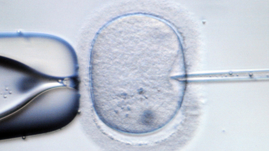 Mikroskopische Aufnahme einer menschlichen Eizelle | dpa