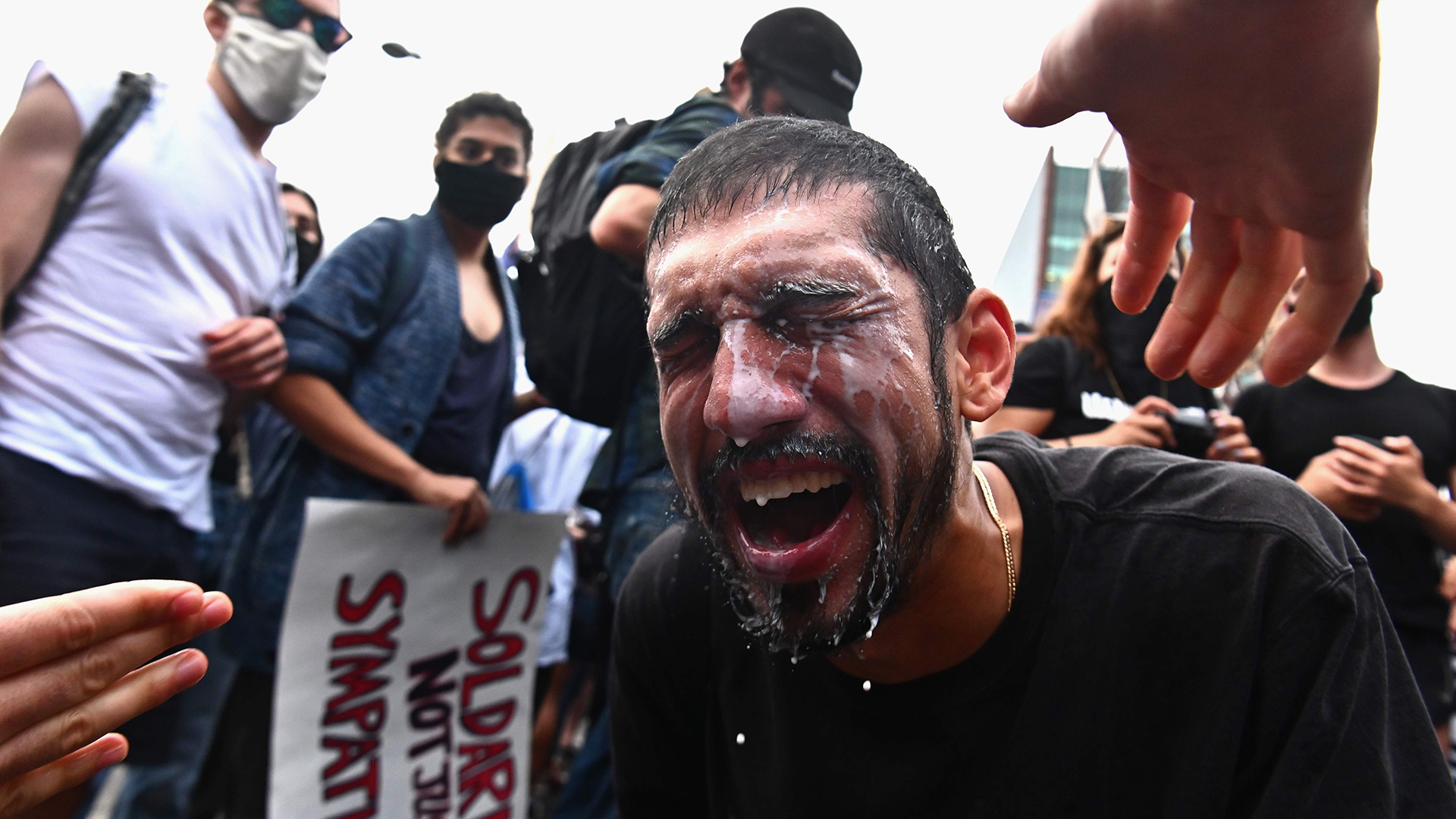 Ein Demonstrant versucht während einer Protestveranstaltung in New York mit Milch, seine von Tränengas getroffenen Augen zu behandeln. | AFP