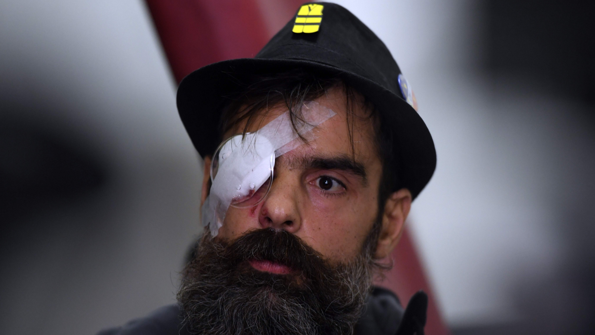 Der am Auge verletzte "Gelbwesten"-Anführer Rodrigues | AFP