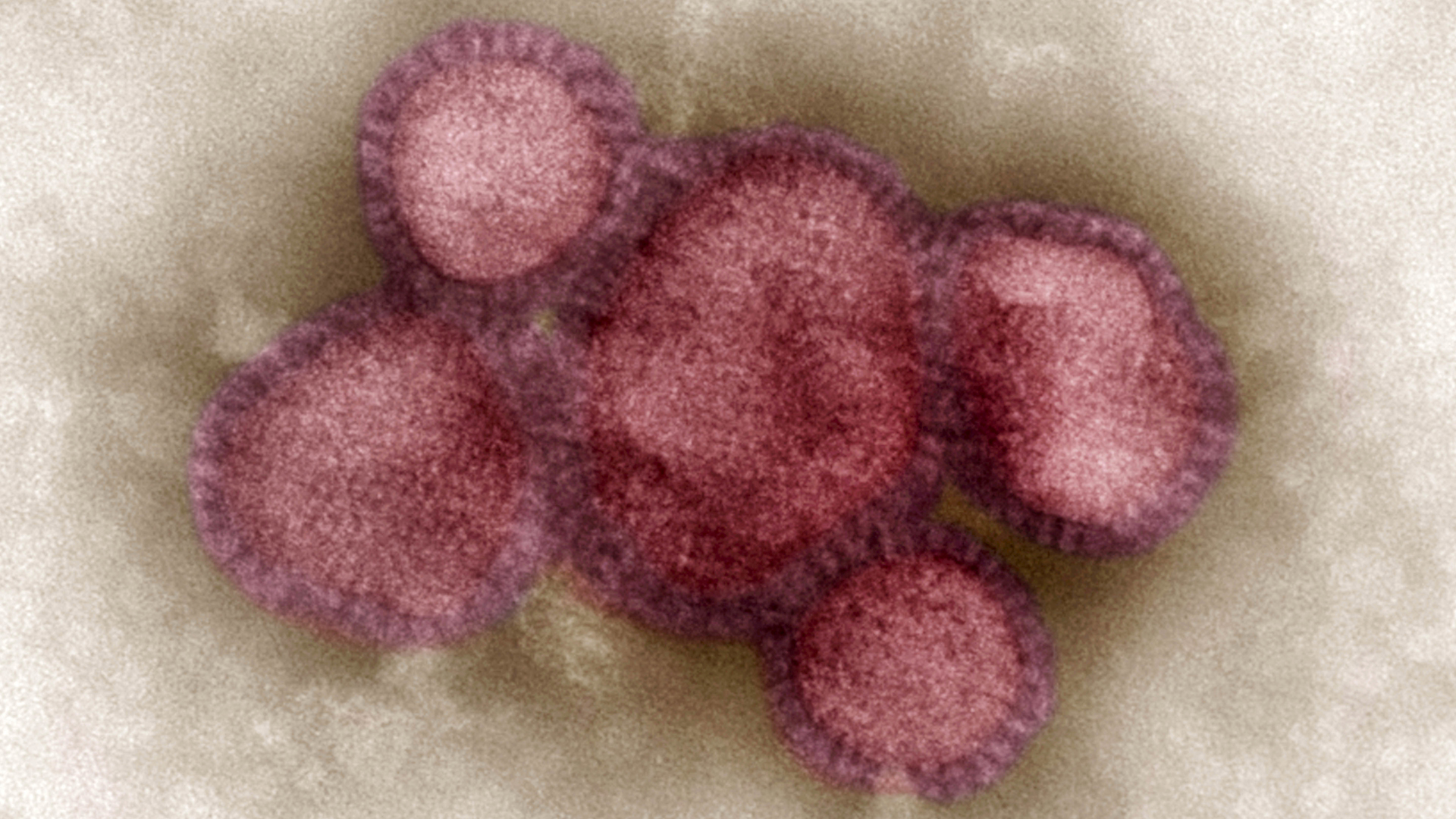 Influenza-A-Viren