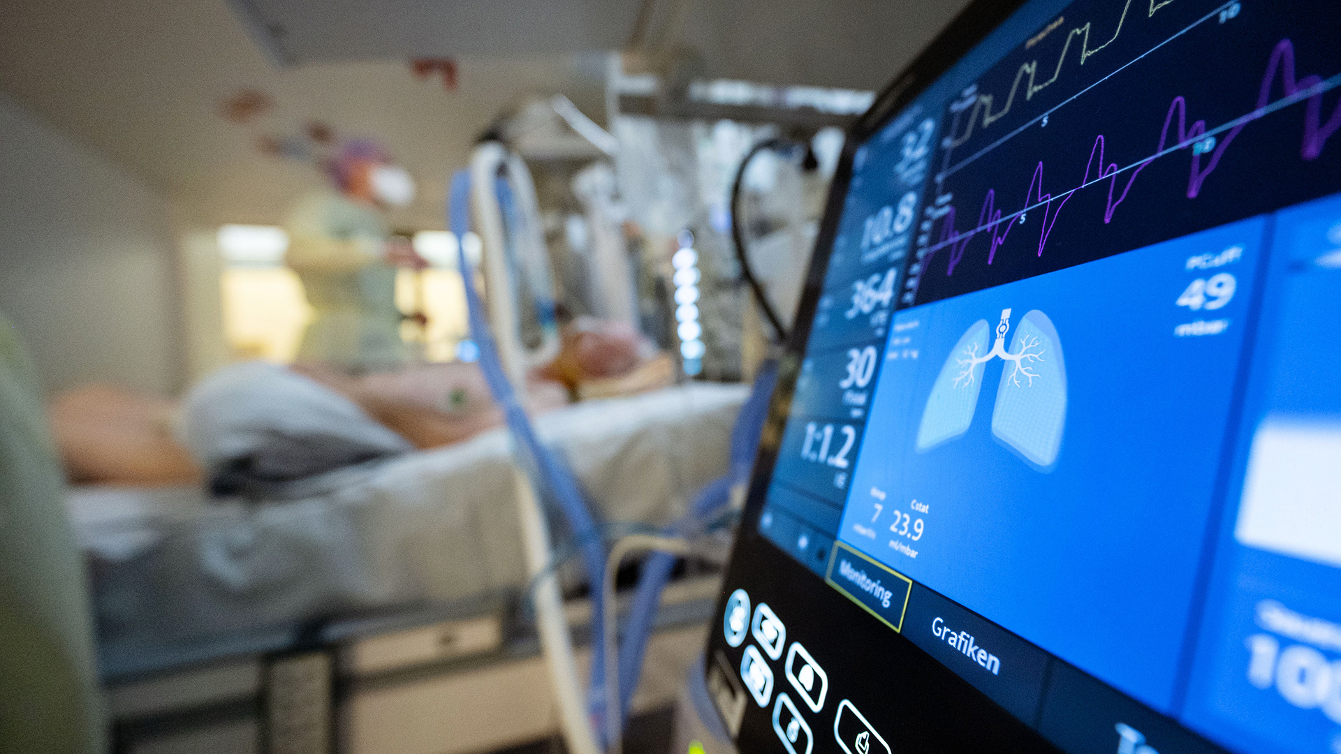 Eine Krankenpflegerin versorgt einen Covid-Patienten auf einer Intensivstation des Klinikum Stuttgart, im Vordergrund ist eine Beatmungsmaschine zu sehen.    | dpa