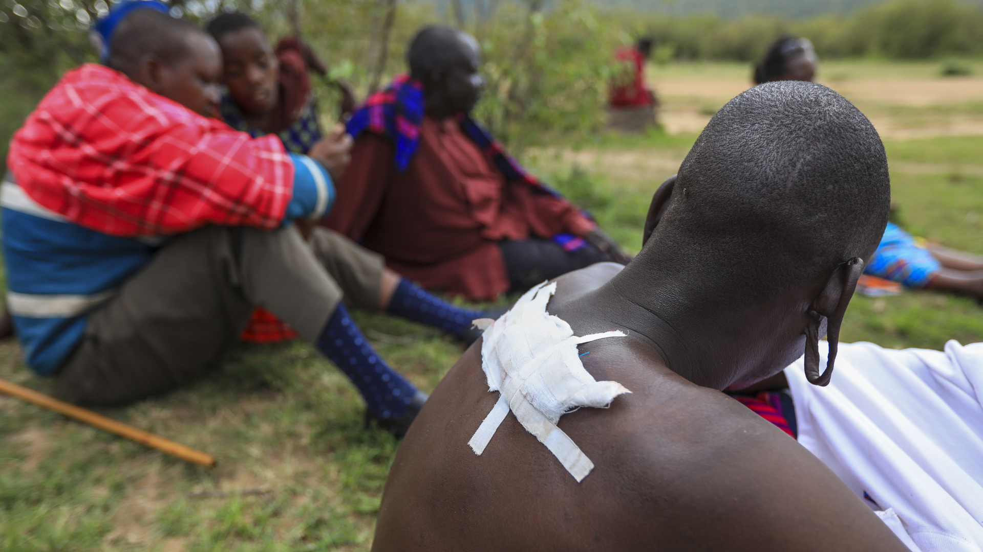 Ein vertriebener Maasai mit einer Rückenverletzung in der Nähe der Grenze zwischen Kenia und Tansania | EPA