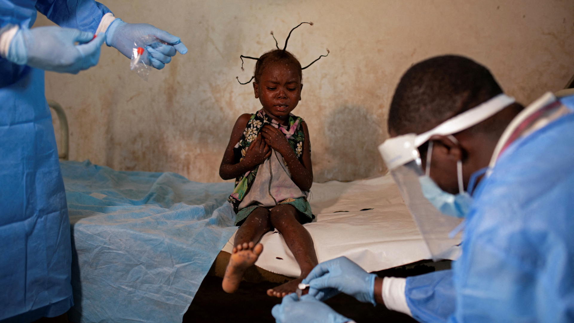 Ein Kind in ärztlicher Behandlung in der Demokratischen Republik Kongo | REUTERS