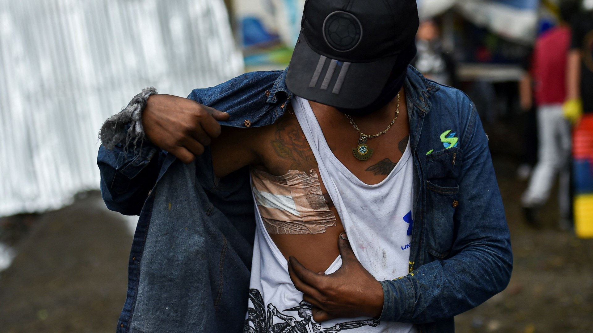 Ein verletzter junger Mann zeigt das große Pflaster an seinem Oberkörper. | AFP