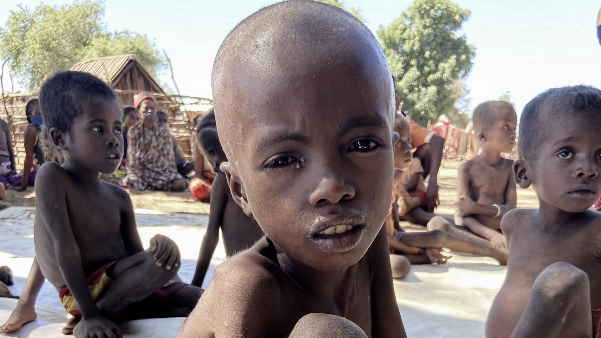Hungernde Kinder im Süden Madagaskars | dpa