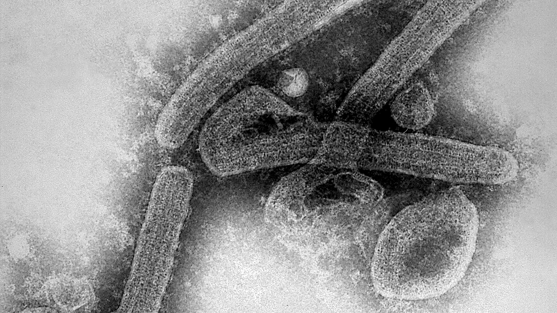 Marburg-Virus breitet sich in Äquatorialguinea weiter aus