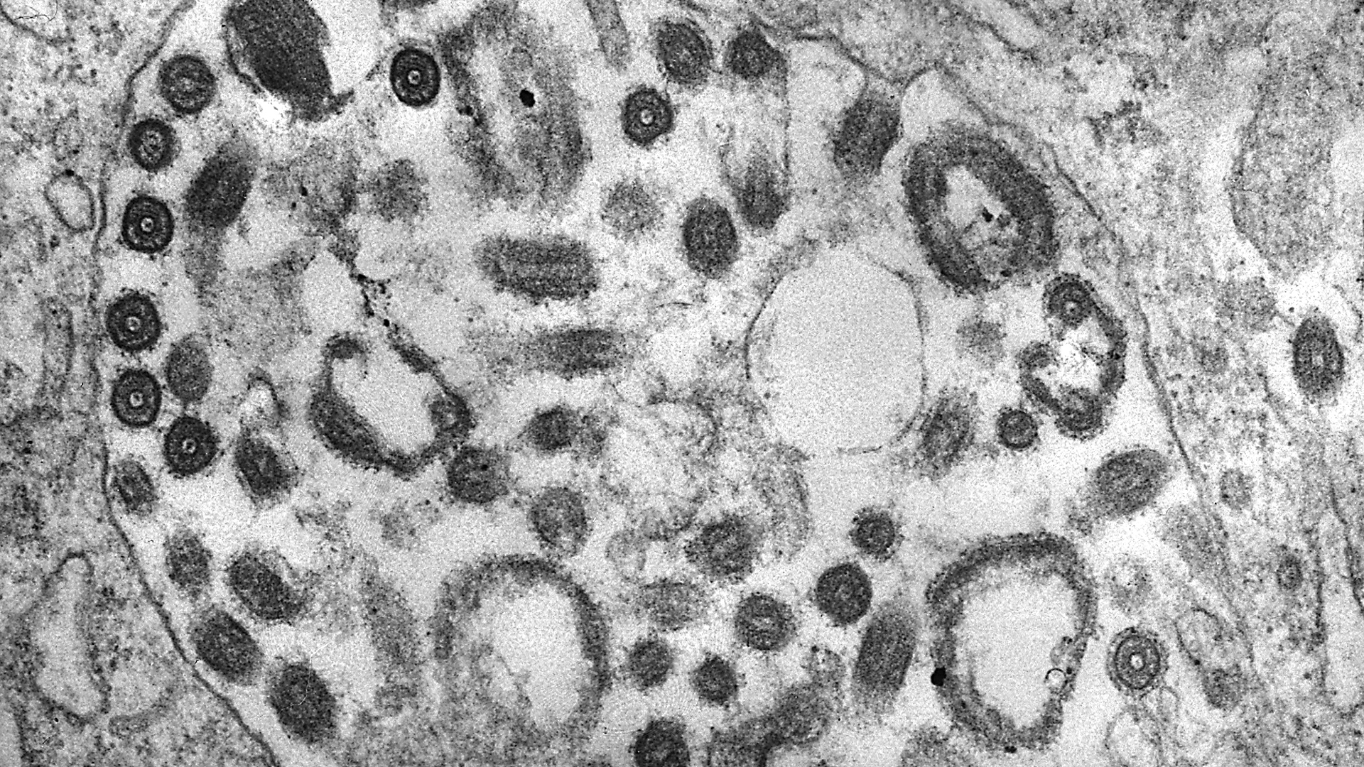 Eine Gewebeprobe zeigt das Vorhandensein zahlreicher Marburg-Viruspartikel. | dpa