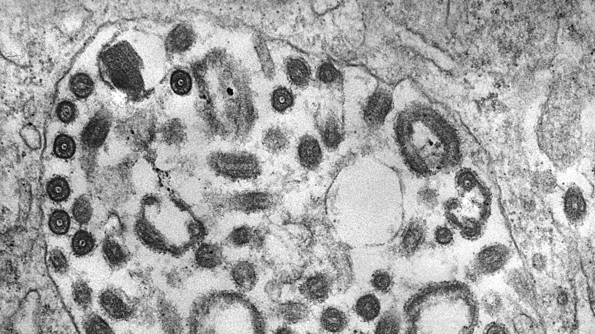  Die Transmissionselektronenmikroskopie (TEM) einer Gewebeprobe zeigt das Vorhandensein zahlreicher Marburg-Viruspartikel (Archivbild). | dpa