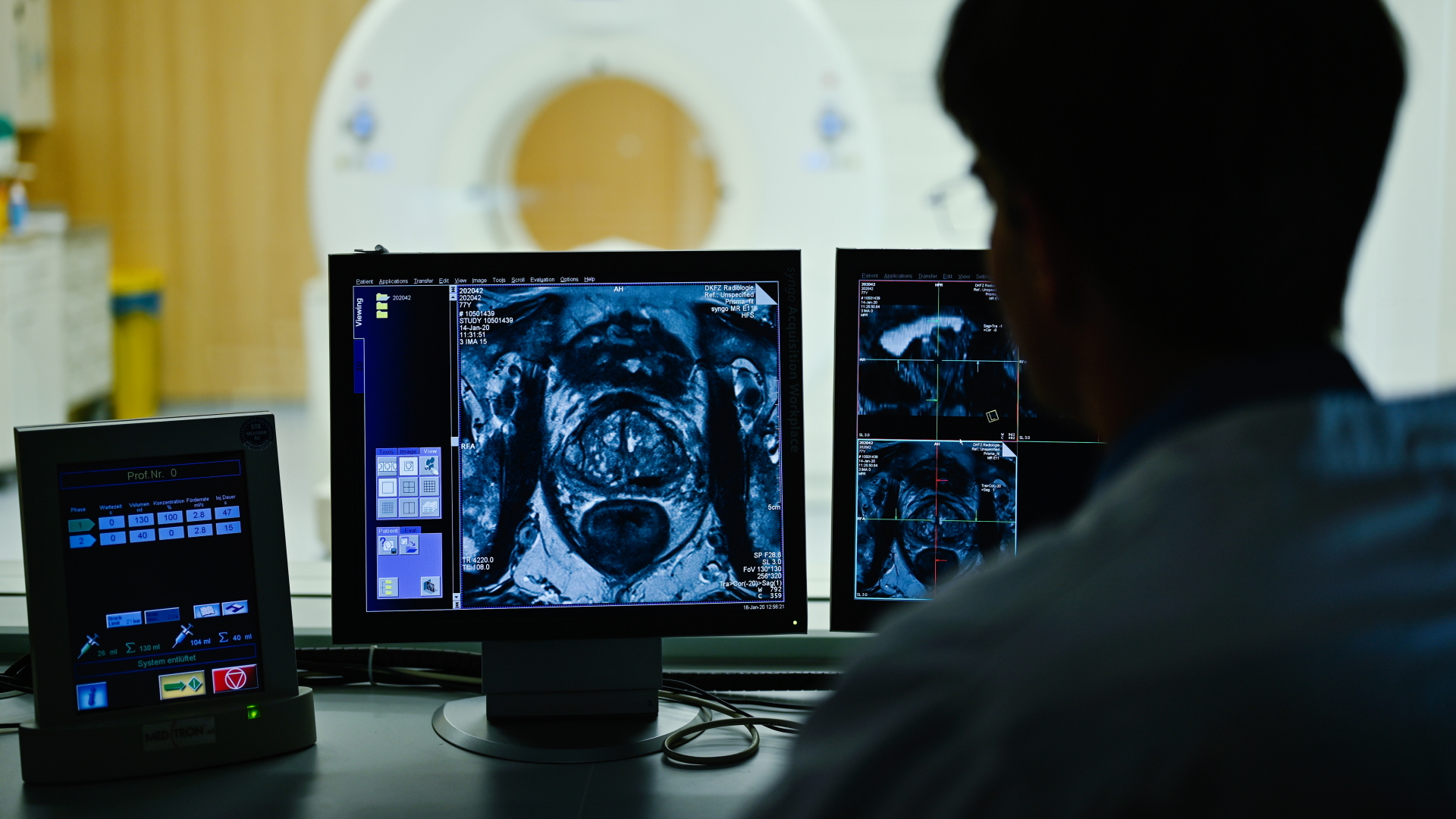 Ein Mitarbeiter betrachtet in einem Kontrollraum des Deutschen Krebsforschungszentrum (DKFZ) auf einem Monitor das Querschnittsbild einer Prostata.  | dpa