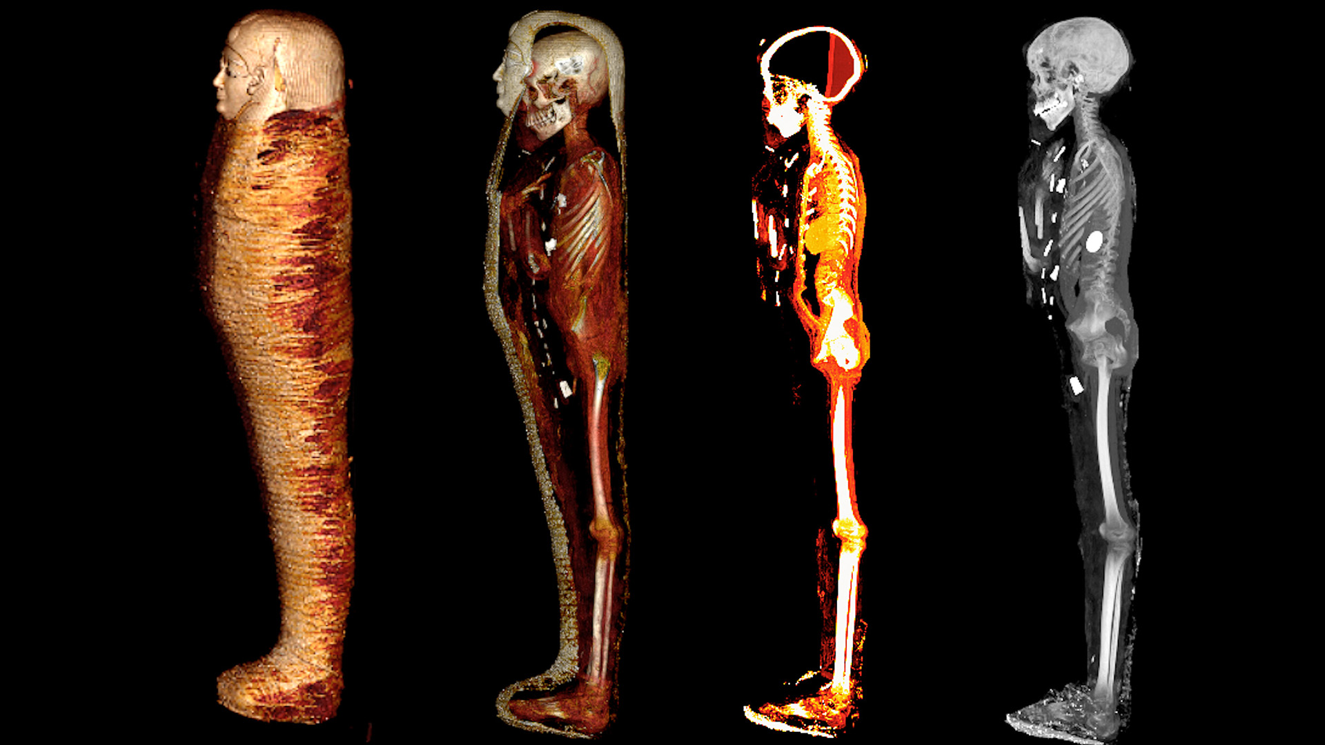Das digitale Abbild zeigt das Innere der Mumie "Goldjunge" in vier Schichten. | dpa