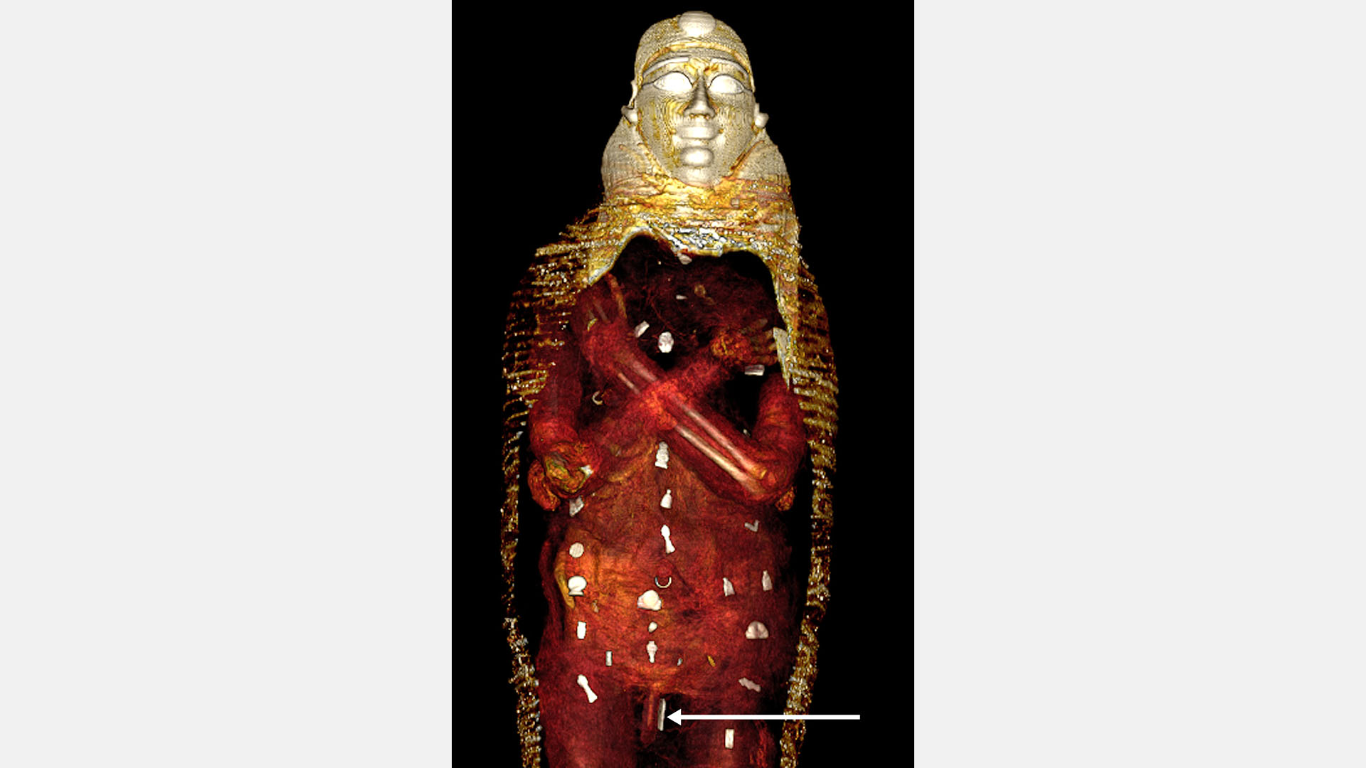 Das digitale Abbild zeigt die Amulette (weiß), die in drei Spalten im Inneren der Mumie "Goldjunge" platziert wurden.  | dpa
