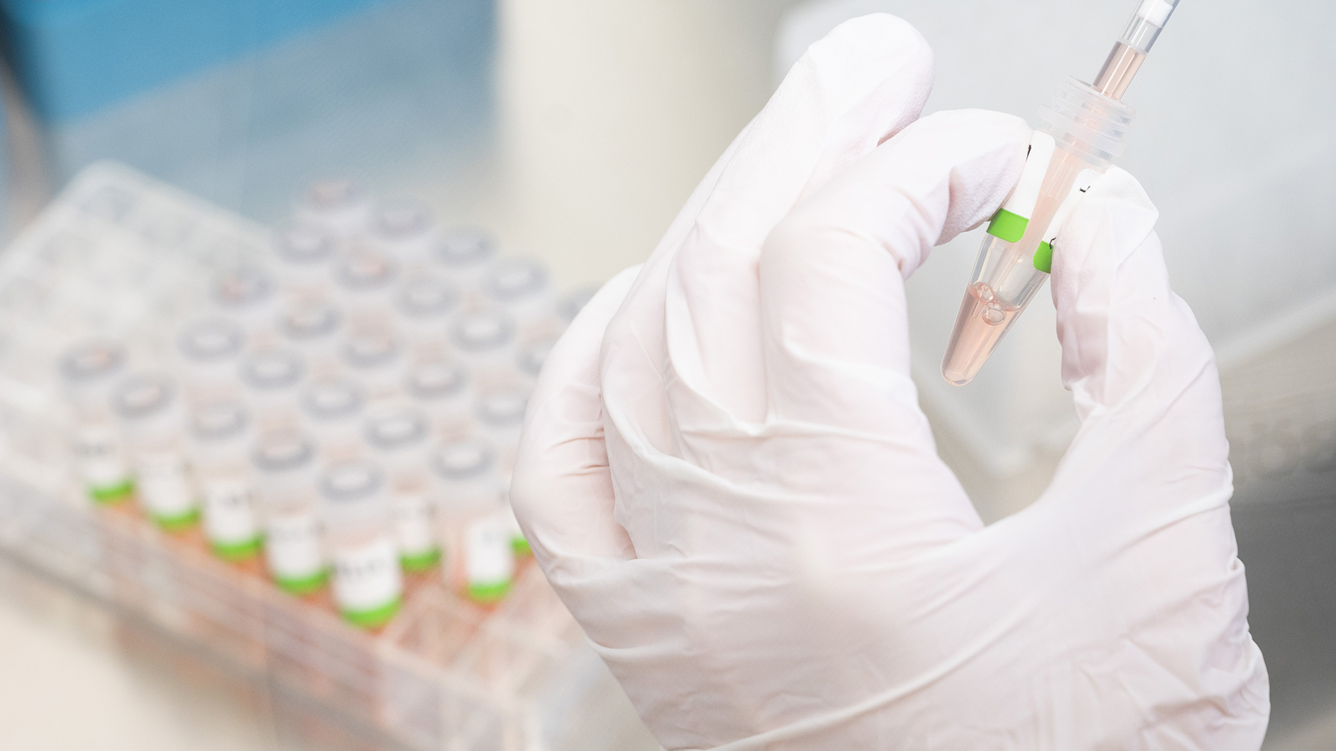 Eine biologisch-technische Assistentin bereitet PCR-Tests auf das Coronavirus von Patienten im PCR-Labor vor. | dpa