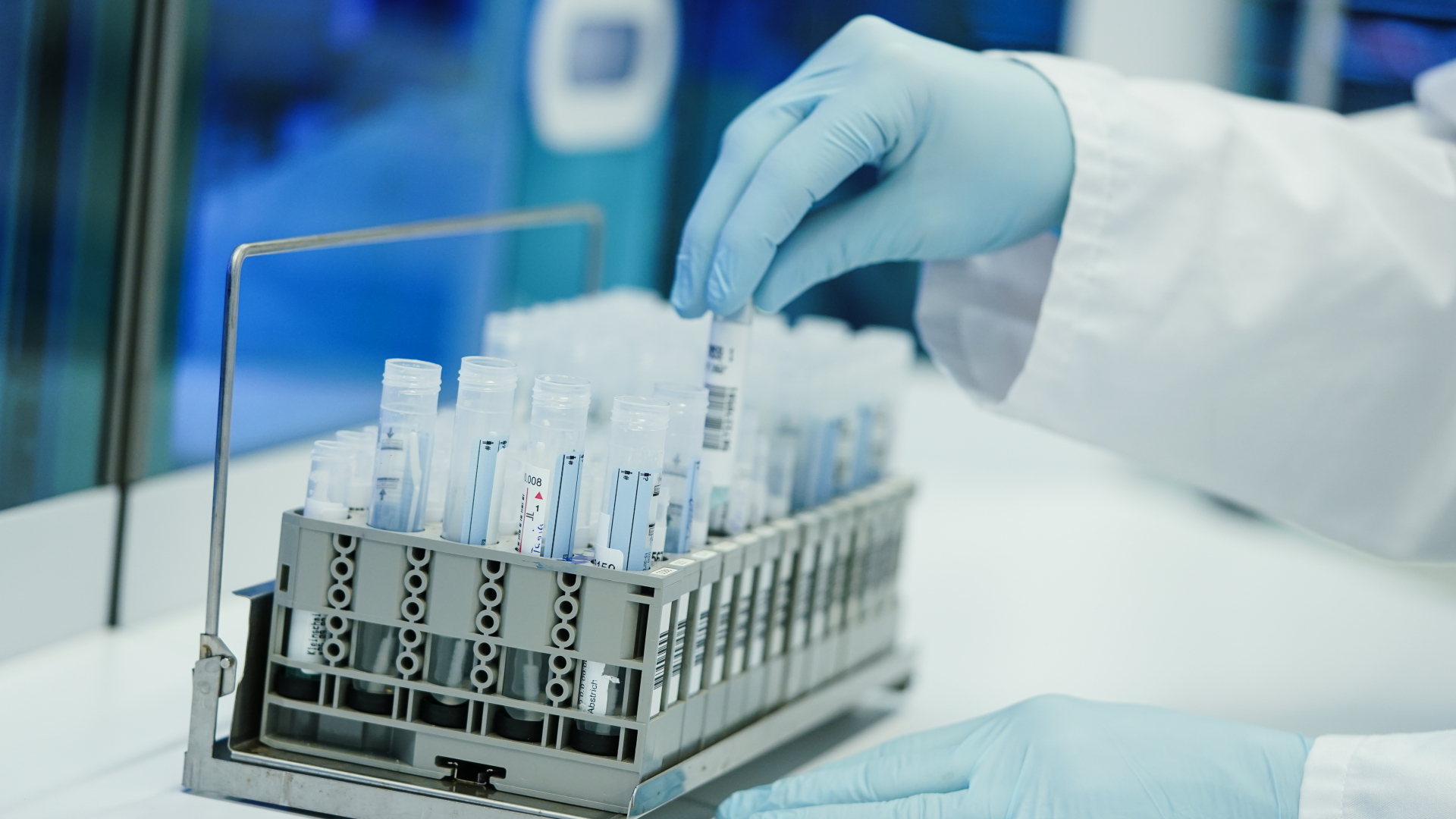 Ein Mitarbeiter hält in einem Coronatest-Labor der Limbach Gruppe PCR-Teströhrchen in den Händen. | dpa