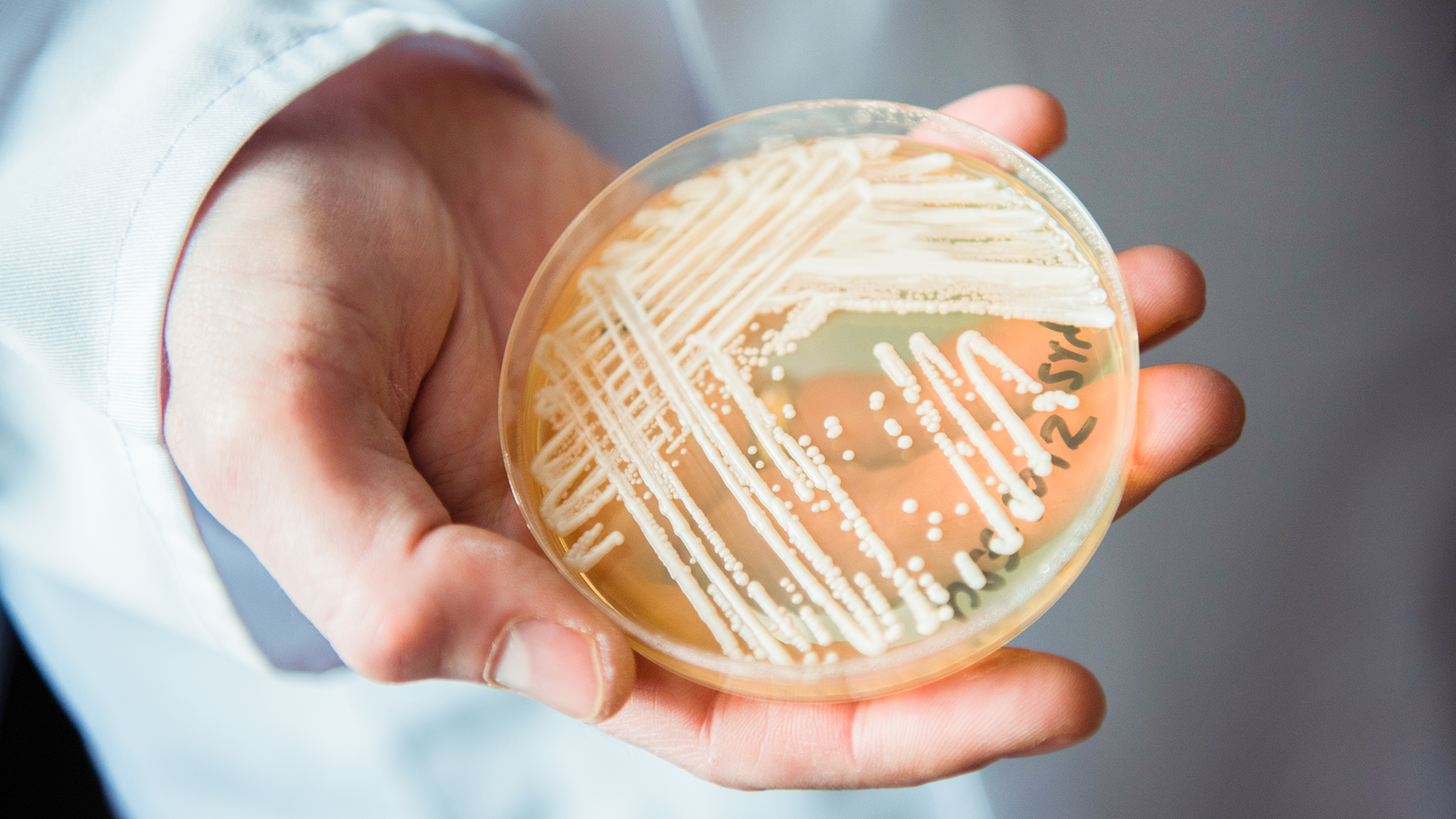 Ein Mitarbeiter hält in einem Labor der Universität in Würzburg (Bayern) eine Petrischale mit dem Hefepilz "Candida auris".  | picture alliance / Nicolas Armer