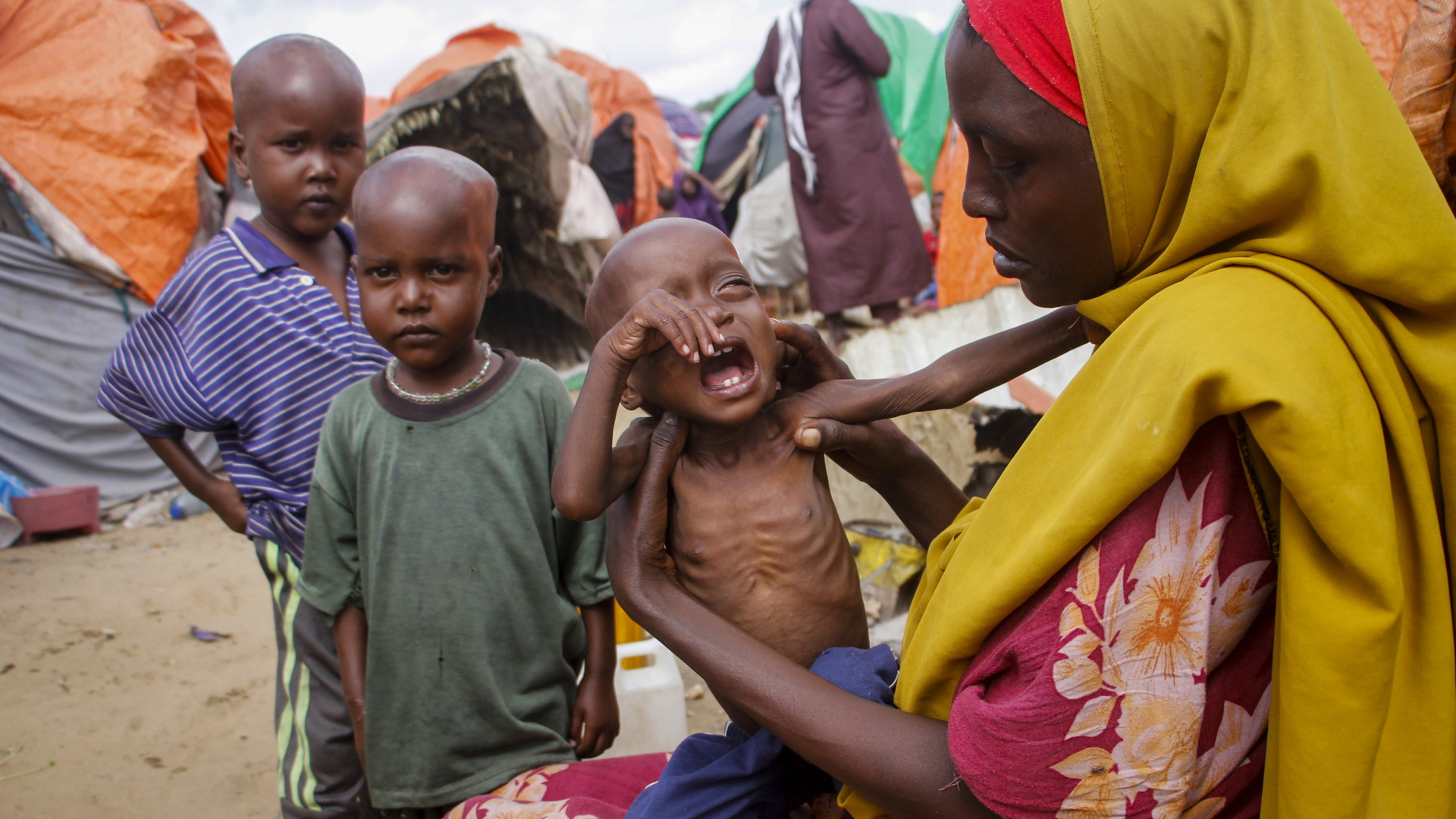 Eine Mutter hält in der somalischen Region Shabeellaha Hoose ihr unterernährtes Kind im Arm.  | AP