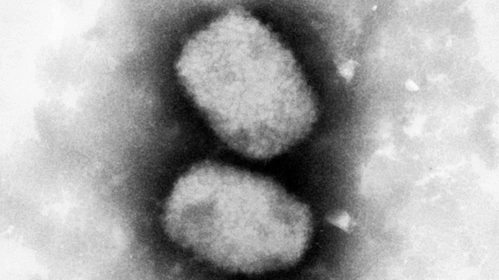 Diese vom Robert Koch-Institut (RKI) zur Verfügung gestellte elektronenmikroskopische Aufnahme zeigt das Affenpockenvirus. | dpa