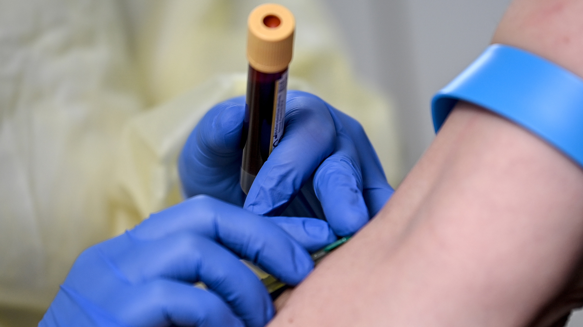 Eine medizinische Mitarbeiterin entnimmt eine Blutprobe. | picture alliance/dpa/dpa-Zentral