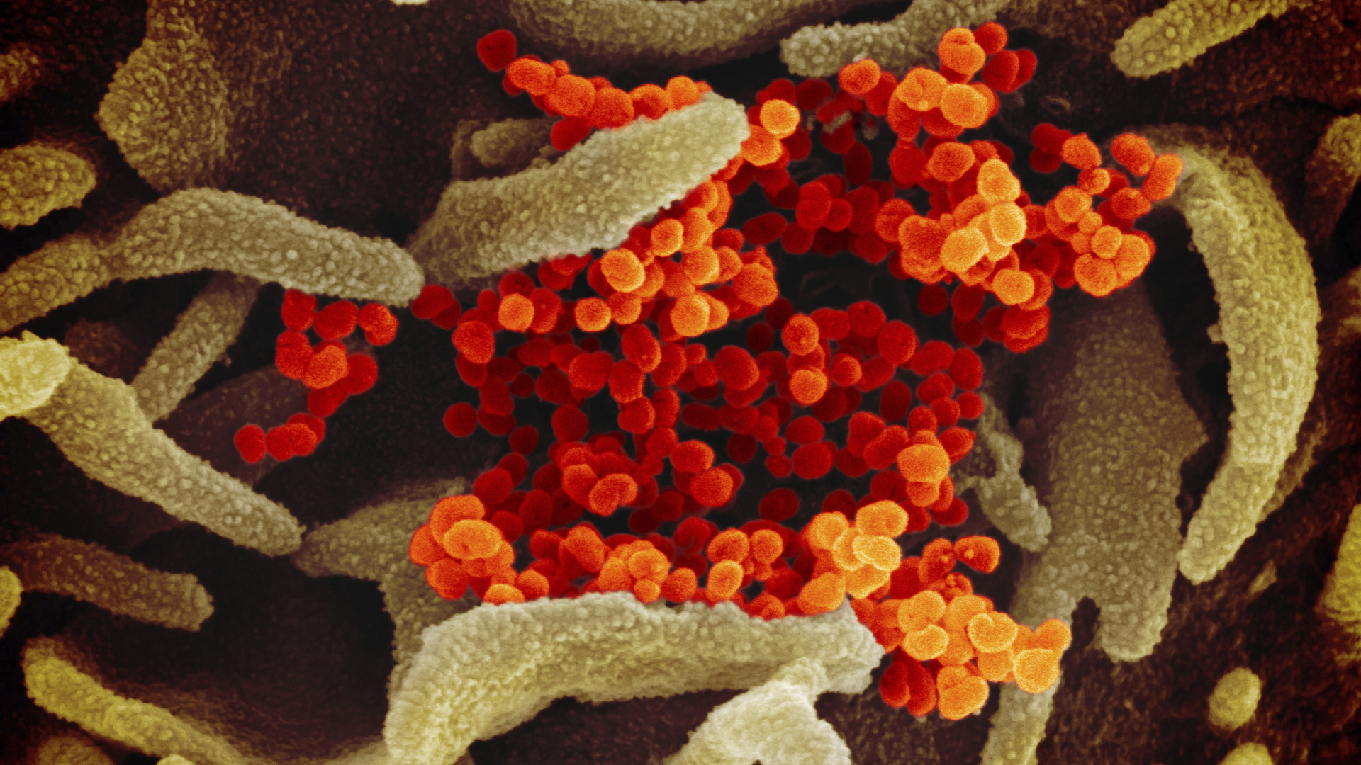 Eine elektronenmikroskopische Aufnahme des "U.S. National Institute of Health" zeigt das neuartige Coronavirus (orange), das aus der Oberfläche von im Labor kultivierten Zellen (grau) austritt. | dpa