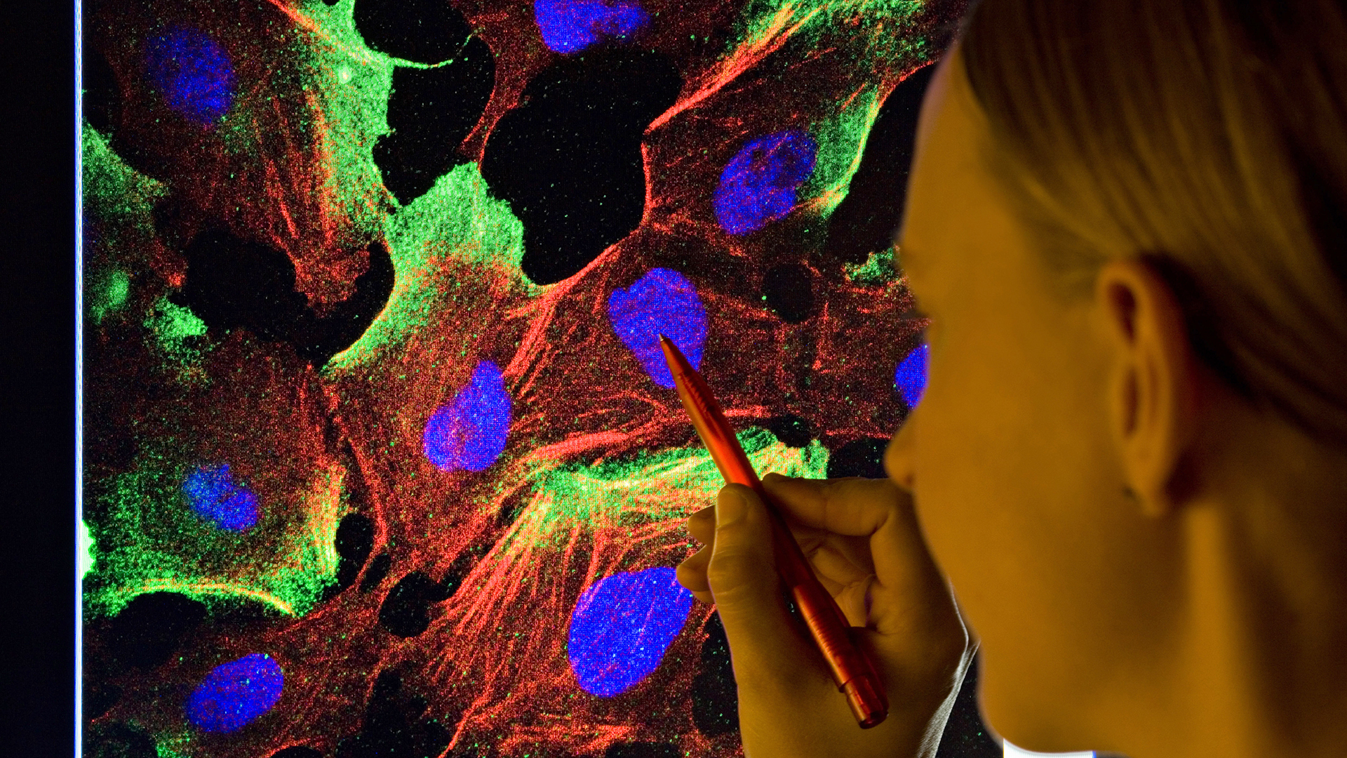 Eine Wissenschaftlerin betrachtet Krebszellen in tausendfacher Vergrösserung. | picture alliance / Jürgen Löse