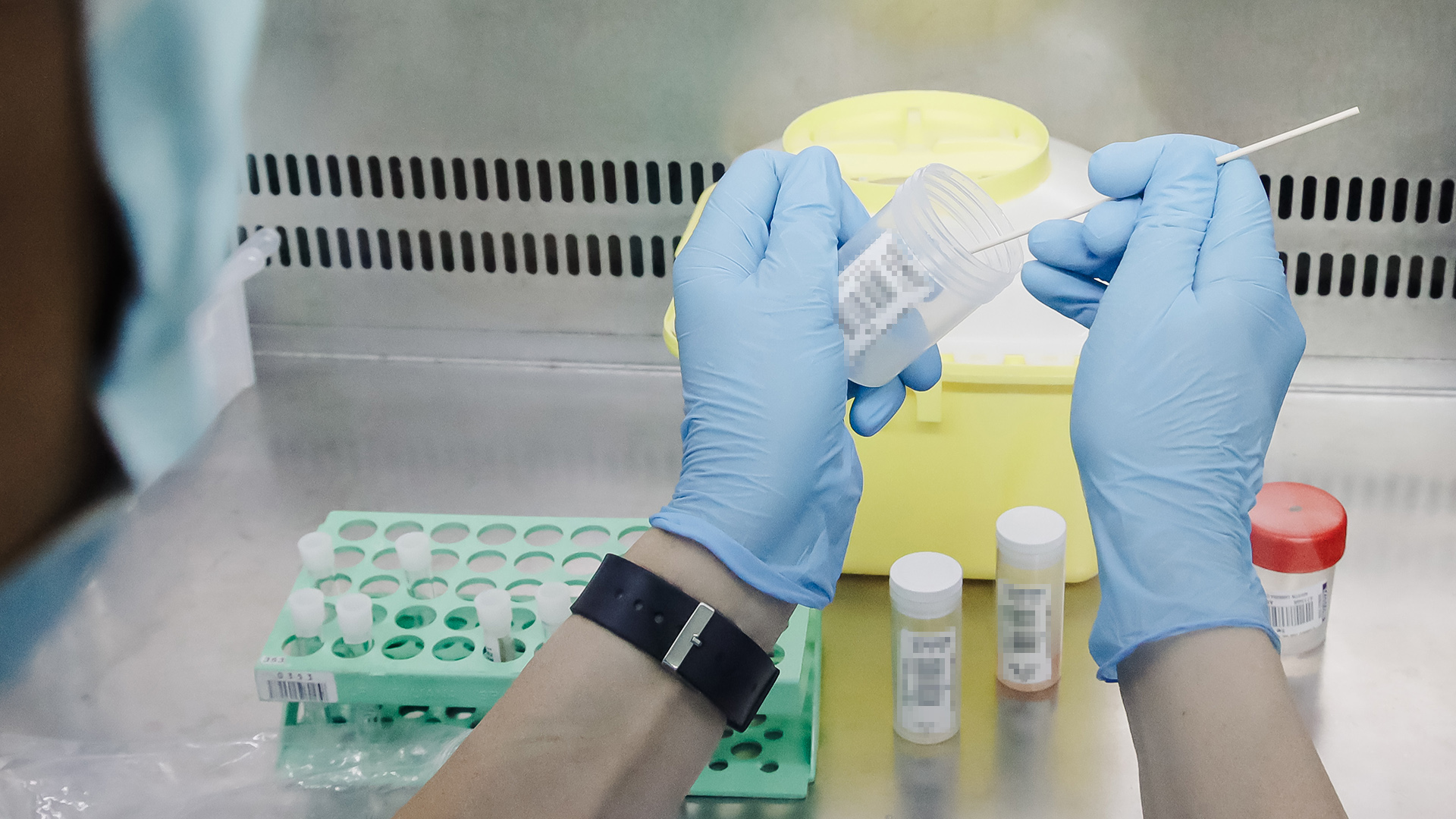 Eine Krankenschwester führt im Krankenhaus "Ramon y Cajal" in Madrid einen PCR-Test zur Erkennung des Affenpockenvirus durch.  | dpa