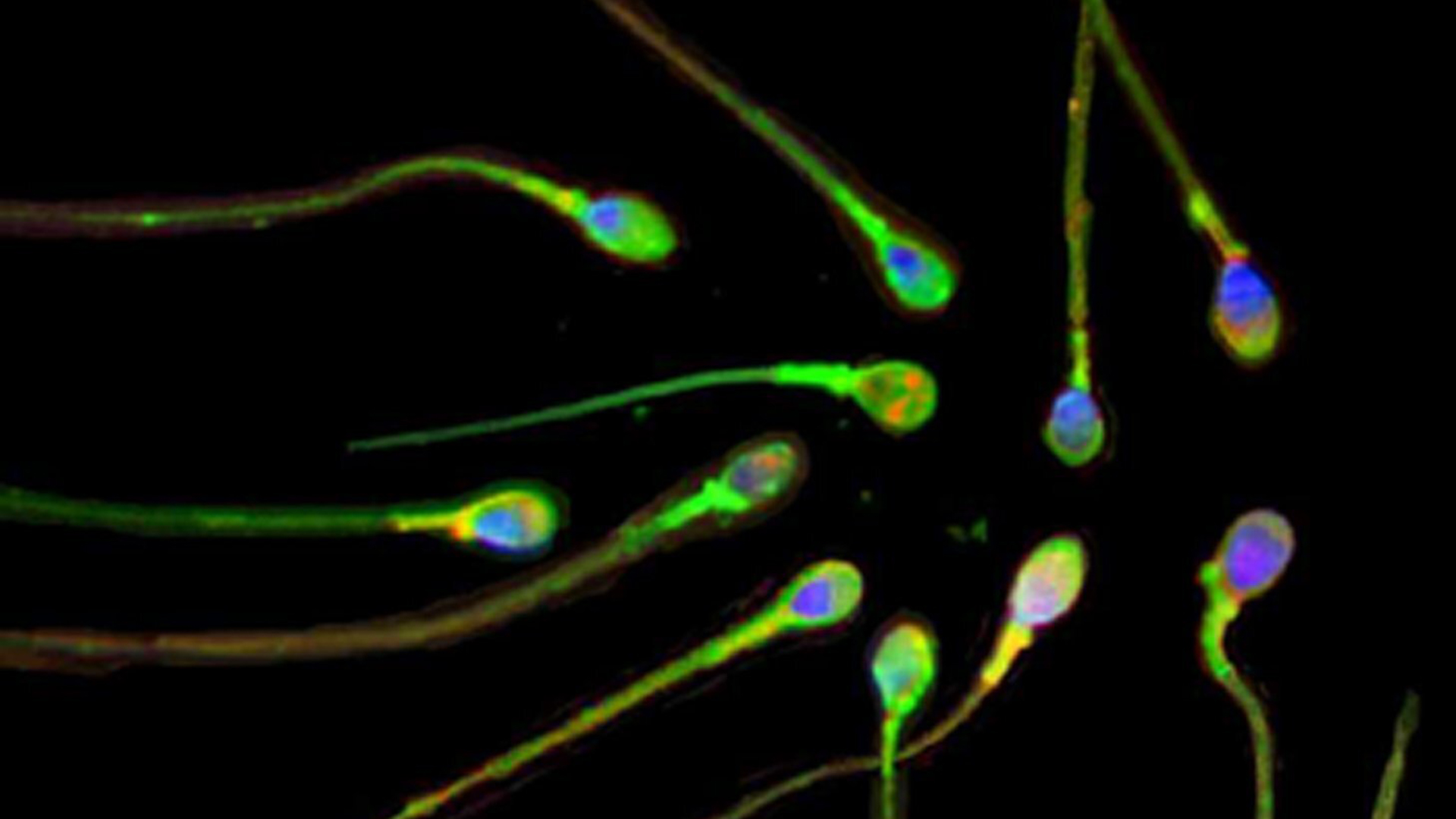 Die undatierte Aufnahme zeigt Spermien unter dem Mikroskop. | picture-alliance / dpa